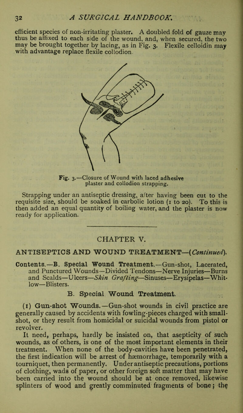 efficient species of non-irritating plaster. A doubled fold of gauze may thus be affixed to each side of the wound, and, when secured, the two may be brought together by lacing, as in Fig. 3. Flexile celloidin may with advantage replace flexile collodion Fig. 3.—Closure of Wound with laced adhesive plaster and collodion strapping. Strapping under an antiseptic dressing, after having been cut to the requisite size, should be soaked in carbolic lotion (1 to 20). To this is then added an equal quantity of boiling water, and the plaster is now ready for application. CHAPTER V. ANTISEPTICS AND WOUND TREATMENT—(Continued)* Contents.—B. Special Wound Treatment.—Gun-shot, Lacerated, and Punctured Wounds—Divided Tendons—Nerve Injuries—Burns and Scalds—Ulcers—Skin Grafting—Sinuses—Erysipelas—Whit- low—Blisters. B. Special Wound Treatment. (1) Gun-shot Wounds.—Gun-shot wounds in civil practice are generally caused by accidents with fowling-pieces charged with small- shot, or they result from homicidal or suicidal wounds from pistol or revolver. It need, perhaps, hardly be insisted on, that asepticity of such wounds, as of others, is one of the most important elements in their treatment. When none of the body-cavities have been penetrated, the first indication will be arrest of haemorrhage, temporarily with a tourniquet, then permanently. Under antiseptic precautions, portions of clothing, wads of paper, or other foreign soft matter that may have been carried into the wound should be at once removed, likewise splinters of \yood and greatly comminuted fragments of boue j thf