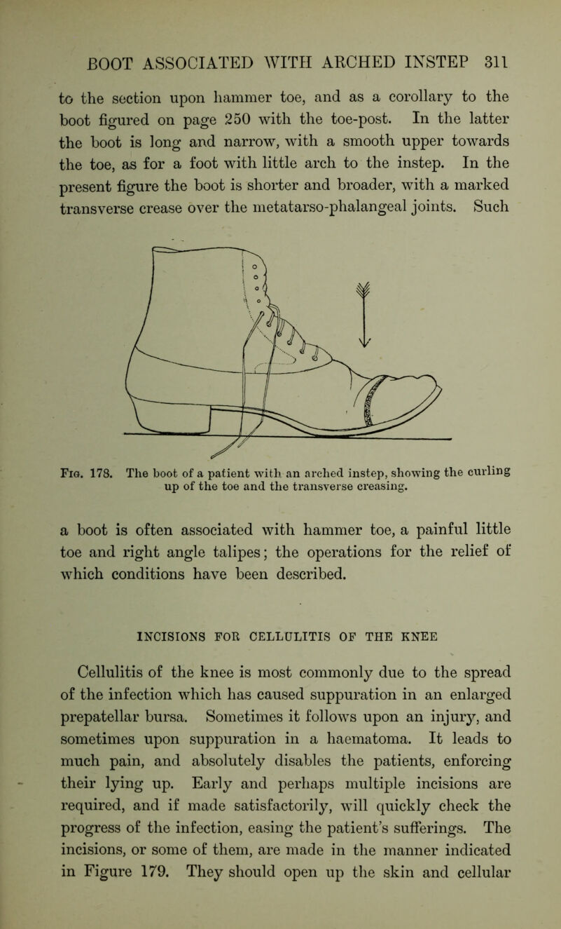 to the section upon hammer toe, and as a corollary to the boot figured on page 250 with the toe-post. In the latter the boot is long and narrow, with a smooth upper towards the toe, as for a foot with little arch to the instep. In the present figure the boot is shorter and broader, with a marked transverse crease over the metatarso-phalangeal joints. Such Fig. 178. The boot of a patient with an arched instep, showing the curling up of the toe and the transverse creasing. a boot is often associated with hammer toe, a painful little toe and right angle talipes; the operations for the relief of which conditions have been described. INCISIONS FOR CELLULITIS OF THE KNEE Cellulitis of the knee is most commonly due to the spread of the infection which has caused suppuration in an enlarged prepatellar bursa. Sometimes it follows upon an injury, and sometimes upon suppuration in a haematoma. It leads to much pain, and absolutely disables the patients, enforcing their lying up. Early and perhaps multiple incisions are required, and if made satisfactorily, will quickly check the progress of the infection, easing the patient’s sufferings. The incisions, or some of them, are made in the manner indicated in Figure 179. They should open up the skin and cellular