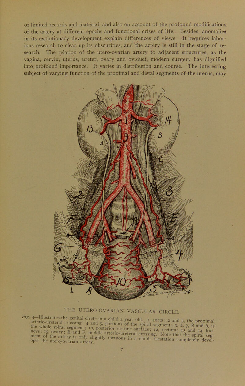 of limited records and material, and also on account of the profound modifications of the artery at different epochs and functional crises of life. Besides, anomalies in its evolutionary development explain differences of views. It requires labor- ious research to clear up its obscurities, and the artery is still in the stage of re- search. The relation of the utero-ovarian artery t'o adjacent structures, as the vagina, cervix, uterus, ureter, ovary and oviduct, modern surgery has dignified into profound importance. It varies in distribution and course. The interesting subject of varying function of the proximal and distal segments of the uterus, mav THE UTERO-OVARIAN VASCULAR CIRCLE. Fig. 4 Illustrates the genital circle in a child a year old i aorta • a nnH , „ • ,