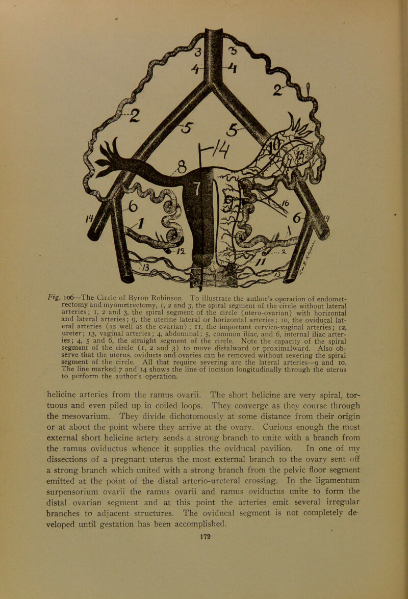 Fig. 106—The Circle of Byron Robinson. To illustrate the author’s operation of endomet- rectomy and myometrectomy, 1, 2 and 3, the spiral segment of the circle without lateral arteries; 1, 2 and 3, the spiral segment of the circle (utero-ovarian) with horizontal and lateral arteries; 9, the uterine lateral or horizontal arteries; 10, the oviducal lat- eral arteries (as well as the ovarian) ; 11, the important cervico-vaginal arteries; 12, ureter; 13, vaginal arteries; 4, abdominal; 5, common iliac, and 6, internal iliac arter- ies; 4, 5 and 6, the straight segment of the circle. Note the capacity of the spiral segment of the circle (x, 2 and 3) to move distalward or proximalward. Also ob- serve that the uterus, oviducts and ovaries can be removed without severing the spiral segment of the circle. All that require severing are the lateral arteries—9 and 10. The line marked 7 and 14 shows the line of incision longitudinally through the uterus to perform the author’s operation. helicine arteries from the ramus ovarii. The short helicine are very spiral, tor- tuous and even piled up in coiled loops. They converge as they course through the mesovarium. They divide dichotomously at some distance from their origin or at about the point where they arrive at the ovary. Curious enough the most external short helicine artery sends a strong branch to unite with a branch from the ramus oviductus whence it supplies the oviducal pavilion. In one of my dissections of a pregnant uterus the most external branch to the ovary sent off a strong branch which united with a strong branch from the pelvic floor segment emitted at the point of the distal arterio-ureteral crossing. In the ligamentum surpensorium ovarii the ramus ovarii and ramus oviductus unite to form the distal ovarian segment and at this point the arteries emit several irregular branches to adjacent structures. The oviducal segment is not completely de- veloped until gestation has been accomplished.