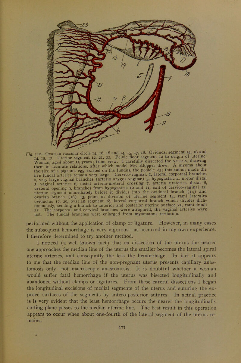 Fig xx2—Ovarian vascular circle 14, 16, 18 and 14, 15, 17, 18. Oviducal segment 14, 16 and 14, 15, 17- Uterine segment 12, 21, 22. Pelvic door segment 12 to origin of uterine. Woman, aged about 55 years; front view. I carefully dissected the vessels, drawing them in'accurate relations, after which model Mr. Klopper drew. A myoma about the size of a pigeon’s egg existed on the fundus, the pedicle 23; this tumor made the five fundal arteries remain very large. Cervico-vaginal, I, lateral corporeal branches 2, very large vaginal branches (arterio azygos vaginae) 3> hypogastric 4> ureter distal 5, vaginal arteries 6, distal arterio-ureteral crossing arteria ureterica distal 8, ureteral opening 9, branches from hypogastric 10 and 11, exit of cervico-vaginal 12, uterine segment immediately before it divides into the oviducal branch (14) and ovarian branch (16) 13, point of division of uterine segment 14, rami laterales oviductus 17, 20, ovarian segment 18, lateral corporeal branch which divides dich- otomously, sending a branch to anterior and posterior uterine surface 21, rami fundi 22. The corporeal and cervical branches were atrophied, the vaginal arteries were not. The fundal branches were enlarged from myomatous irritation. performed without the application of clamp or ligature. However, in many cases the subsequent hemorrhage is very vigorous—as occurred in my own experience. I therefore determined to try another method. I noticed (a well known fact) that on dissection of the uterus the nearer one approaches the median line of the uterus the smaller becomes the lateral spiral uterine arteries, and consequntly the less the hemorrhage. In fact it appears to me that the median line of the non-pregnant uterus presents capillary anas- tomosis only—not macroscopic anastomosis. It is doubtful whether a woman would suffer fatal hemorrhage if the uterus was bisected longitudinally and abandoned without clamps or ligatures. From these careful dissections I began the longitudinal excisions of medial segments of the uterus and suturing the ex- posed surfaces of the segments by antero-posterior sutures. In actual practice is is very evident that the least hemorrhage occurs the nearer the longitudinally cutting plane passes to the median uterine line. The best result in this operation appears to occur when about one-fourth of the lateral segment of the uterus re- mains.