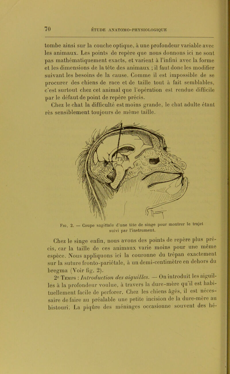 tombe ainsi sur la couche optique, à une profondeur variable avec les animaux. Les points de repère que nous donnons ici ne sont pas mathématiquement exacts, et varient à l’infini avec la forme et les dimensions de la tête des animaux ; il faut donc les modifier suivant les besoins de la cause. Comme il est impossible de se procurer des chiens de race et de taille tout à fait semblables, c'est surtout chez cet animal que l'opération est rendue difficile par le défaut de point de repère précis. Chez le chat la difficulté est moins grande, le chat adulte étant rès sensiblement toujours de même faille. Fia. 2. — Coupe sagittale d’une tète de singe pour montrer le trajet suivi par l’instrument. Chez le singe enfin, nous avons des points de repère plus pré- cis, car la taille de ces animaux varie moins pour une même espèce. Nous appliquons ici la couronne du trépan exactement sur la suture fronto-pariétale, à un demi-centimètre en dehors du bregma (Voir fig. 2). 2e Temps : Introduction des aiguilles. — On introduit les aiguil- les à la profondeur voulue, à travers la dure-mère qu il est habi- tuellement facile de perforer. Chez les chiens âgés, il est néces- saire défaire au préalable une petite incision de la dure-mère au bistouri. La piqûre des méningés occasionne souvent des hé-