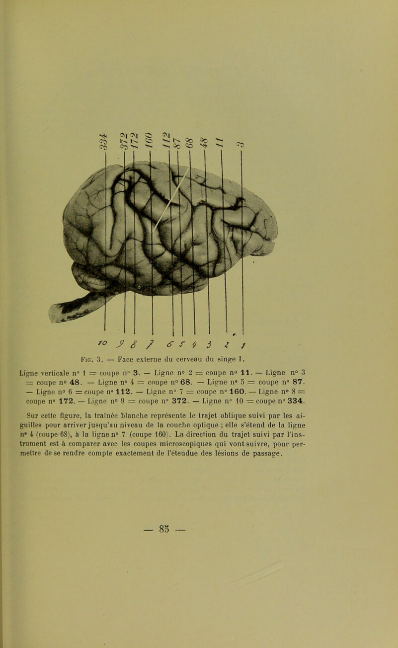*° J> ê / z / Fio. 3. — Face externe du cerveau du singe I. Ligne verticale n° 1 =: coupe n° 3. — Ligne n° 2 = coupe n° 11. — Ligne n° 3 = coupe n° 48. — Ligne n° K — coupe n° 68. — Ligne n» 5 = coupe n° 87. — Ligne n° G = coupe n° 112. — Ligne n° 7 = coupe n 160. — Ligne n° 8 = coupe n° 172. — Ligne n° 9 = coupe n° 372. — Ligne n° 10 ■= coupe n° 334. Sur cette figure, la traînée blanche représente le trajet oblique suivi par les ai- guilles pour arriver jusqu’au niveau de la couche optique ; elle s’étend de la ligne n* K (coupe 68), à la ligne n° 7 (coupe 160). La direction du trajet suivi par l’ins- trument est à comparer avec les coupes microscopiques qui vont suivre, pour per- mettre de se rendre compte exactement de l’étendue des lésions de passage.