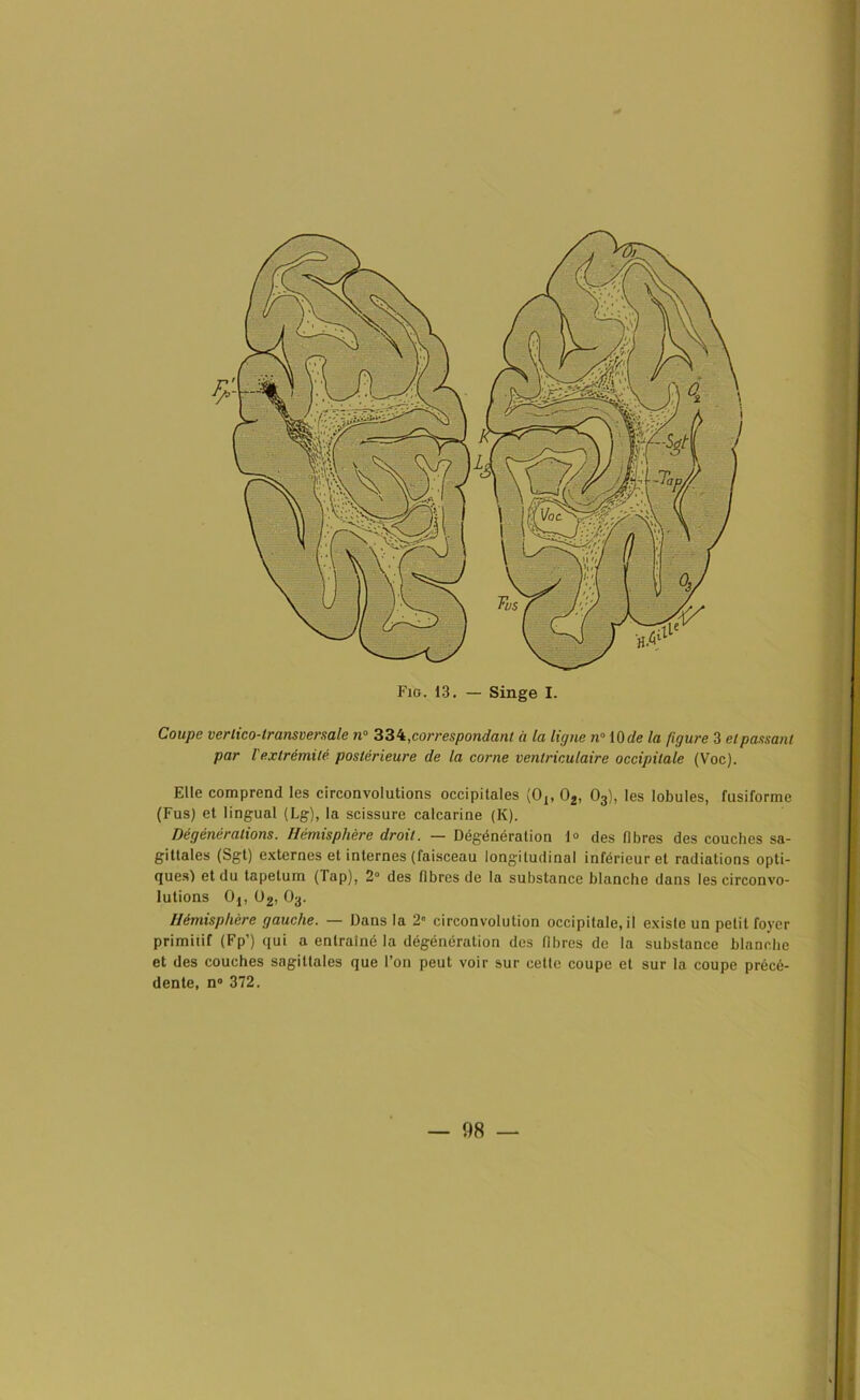 Coupe verlico-transversale n° 334, correspondant à la ligne n° 10 de la figure 3 et pansant par l'extrémité postérieure de la corne ventriculaire occipitale (Voc). Elle comprend les circonvolutions occipitales (Oj, 02, 03), les lobules, fusiforme (Fus) et lingual (Lg), la scissure calcarine (K). Dégénérations. Hémisphère droit. — Dégénération 1° des fibres des couches sa- gittales (Sgt) externes et internes (faisceau longitudinal inférieur et radiations opti- ques) et du tapétum (Tap), 2° des fibres de la substance blanche dans les circonvo- lutions Oj, 02, 03. Hémisphère gauche. —- Dans la 2° circonvolution occipitale.il existe un petit foyer primitif (Fp’) qui a entraîné la dégénération des fibres de la substance blanche et des couches sagittales que l’on peut voir sur cette coupe et sur la coupe précé- dente, n° 372.