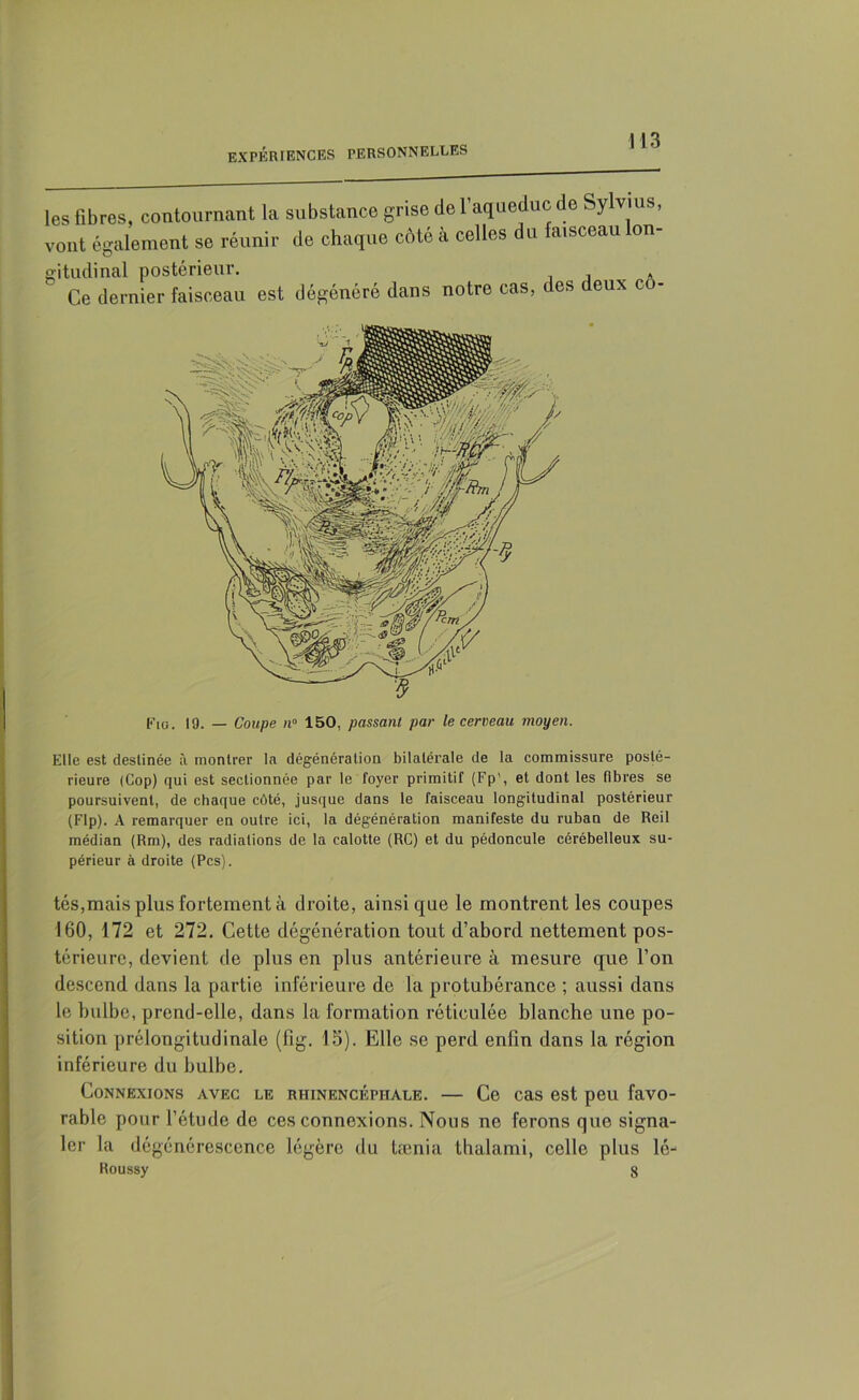 les fibres, contournant la substance grise de l’aqueduc de Sylvms, vont également se réunir de chaque côté à celles du faisceau lon- gitudinal postérieur. Ce dernier faisceau est dégénéré dans notre cas, des deux co- Fio. 19. — Coupe n° 150, passant par le cerveau moyen. Elle est destinée à montrer la dégénération bilatérale de la commissure posté- rieure (Cop) qui est sectionnée par le foyer primitif (Fp', et dont les fibres se poursuivent, de chaque côté, jusque dans le faisceau longitudinal postérieur (Flp). A remarquer en outre ici, la dégénération manifeste du ruban de Reil médian (Rm), des radiations de la calotte (RC) et du pédoncule cérébelleux su- périeur à droite (Pcs). tés,mais plus fortement à droite, ainsique le montrent les coupes 160, 172 et 272. Cette dégénération tout d’abord nettement pos- térieure, devient de plus en plus antérieure à mesure que l’on descend dans la partie inférieure de la protubérance ; aussi dans le bulbe, prend-elle, dans la formation réticulée blanche une po- sition prélongitudinale (fig. 13). Elle se perd enfin dans la région inférieure du huibe. Connexions avec le rhinencéphale. — Ce cas est peu favo- rable pour l’étude de ces connexions. Nous ne ferons que signa- ler la dégénérescence légère du tænia thalami, celle plus lé- Roussy 8