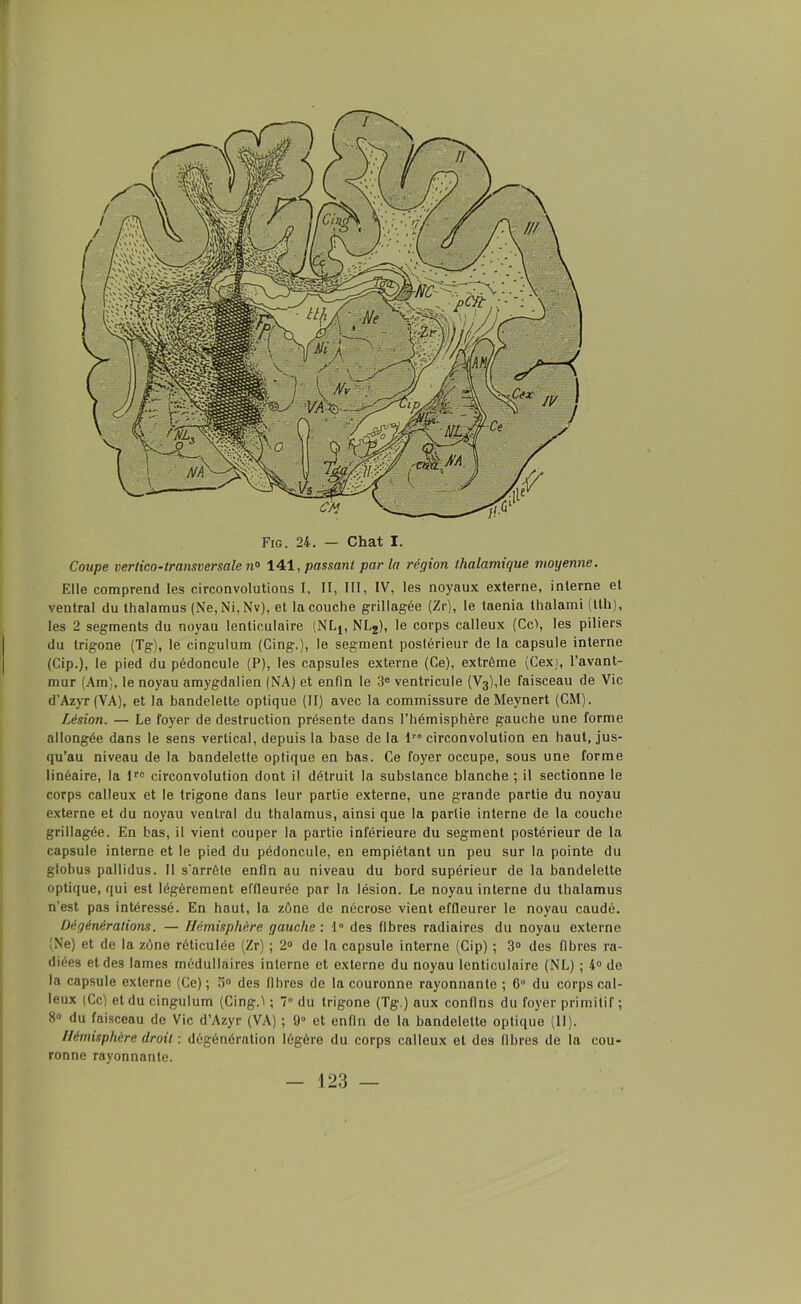 Coupe vertico-lransversale n° 141, passant parla région lhalamtque moyenne. Elle comprend les circonvolutions I, II, III, IV, les noyaux externe, interne et ventral du thalamus (Ne,Ni,Nv), et la couche grillagée (Zr), le taenia thalami (tth), les 2 segments du noyau lenticulaire (NLj, NL2), le corps calleux (Ce), les piliers du trigone (Tg), le cingulum (Cing.), le segment postérieur de la capsule interne (Cip.), le pied du pédoncule (P), les capsules externe (Ce), extrême (Cex), l’avant- mur (Am), le noyau amygdalien (NA) et enfin le 3e ventricule (V3),le faisceau de Vie d’Azyr (VA), et la bandelette optique (II) avec la commissure de Meynert (CM). Lésion. — Le foyer de destruction présente dans l’hémisphère gauche une forme allongée dans le sens vertical, depuis la base de la 1” circonvolution en haut, jus- qu’au niveau de la bandelette optique en bas. Ce foyer occupe, sous une forme linéaire, la lro circonvolution dont il détruit la substance blanche ; il sectionne le corps calleux et le trigone dans leur partie externe, une grande partie du noyau externe et du noyau ventral du thalamus, ainsi que la partie interne de la couche grillagée. En bas, il vient couper la partie inférieure du segment postérieur de la capsule interne et le pied du pédoncule, en empiétant un peu sur la pointe du globus pallidus. Il s'arrête enfin au niveau du bord supérieur de la bandelette optique, qui est légèrement effleurée par la lésion. Le noyau interne du thalamus n’est pas intéressé. En haut, la zône de nécrose vient effleurer le noyau caudé. Dégénérations. — Hémisphère gauche : 1° des fibres radiaires du noyau externe (Ne) et de la zône réticulée (Zr) ; 2° de la capsule interne (Cip) ; 3° des fibres ra- diées et des lames médullaires interne et externe du noyau lenticulaire (NL) ; 4° de la capsule externe (Ce); 3° des fibres de la couronne rayonnante ; 6° du corps cal- leux (Ce) et du cingulum (Cing.) ; 7° du trigone (Tg.) aux confins du foyer primitif ; 8° du faisceau de Vie d’Azyr (VA) ; 9° et enfin de la bandelette optique (11). Hémisphère droit : dégénération légère du corps calleux et des libres de la cou- ronne rayonnante.