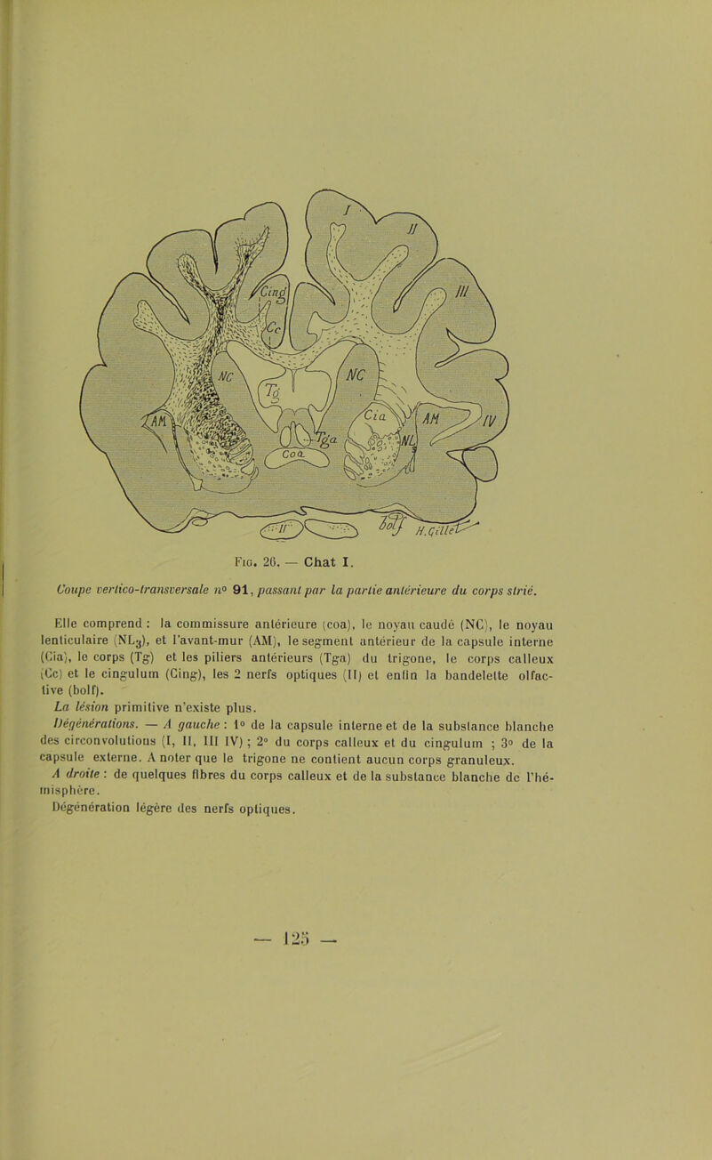 Coupe verlico-transversale n° 91, passant par la partie antérieure du corps strié. Elle comprend: la commissure antérieure (coa), le noyau caudé (NC), le noyau lenticulaire (NL-j), et l'avant-mur (AM), le segment antérieur de la capsule interne (Cia), le corps (Tg) et les piliers antérieurs (Tga) du trigone, le corps calleux (Ce) et le cingulum (Cing), les 2 nerfs optiques (II) et enfin la bandelette olfac- tive (bolf). La lésion primitive n’existe plus. Dégénéralions. — A gauche : 1° de la capsule interne et de la substance blanche des circonvolutions (I, II, III IV) ; 2° du corps calleux et du cingulum ; 3° de la capsule externe. A noter que le trigone ne contient aucun corps granuleux. A droite : de quelques fibres du corps calleux et de la substance blanche de l’hé- misphère. Dégénération légère des nerfs optiques.