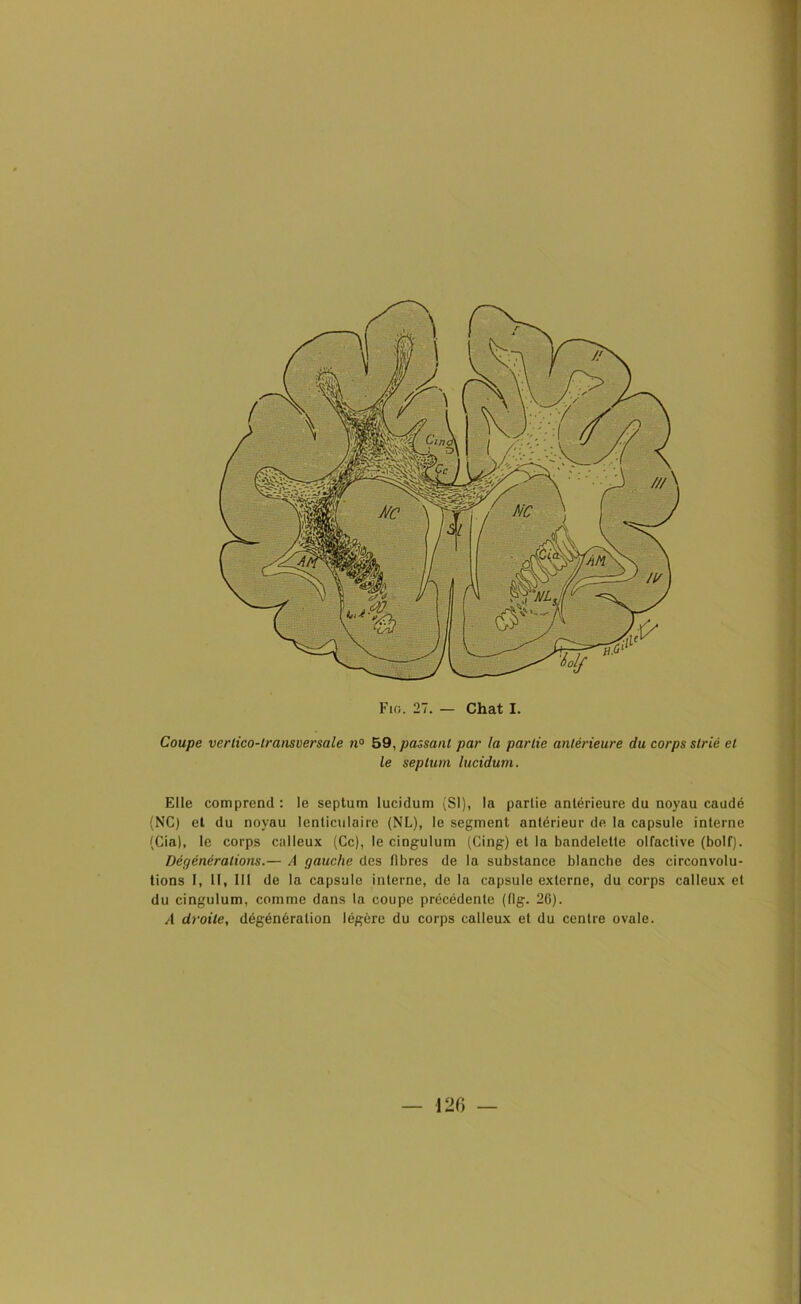 Coupe vertico-lransversale n° 59, passant par la partie antérieure du corps strié et le septum lucidum. Elle comprend : le septum lucidum (SI), la partie antérieure du noyau caudé (NC) et du noyau lenticulaire (NL), le segment antérieur de la capsule interne (Cia), le corps calleux (Ce), le cingulum (Cing) et la bandelette olfactive (bolf). Dégénérations.— A gauche des fibres de la substance blanche des circonvolu- tions I, 11, III de la capsule interne, de la capsule externe, du corps calleux et du cingulum, comme dans la coupe précédente (flg. 26). A droite, dégénéralion légère du corps calleux et du centre ovale. — 120 —
