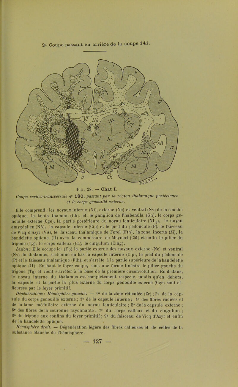 Coupe verlico-transversale n° 180, passant par la répion tlialamique postérieure et le corps genouillé externe. Elle comprend : les noyaux interne (Ni), externe (Ne) et ventral (Nv) de la couche optique, le tænia thalami (tlh), et le ganglion de l’habenula (Gh), le corps ge- nouillé externe (Cge), la partie postérieure du noyau lenticulaire (NL3), le noyau amygdalien (NA), la capsule interne (Cip) et le pied du pédoncule (P), le faisceau de Vicq d'Azyr (VA), le faisceau thalamique de Forel (Fth), la zona incerta (Zi), la bandelette optique (II) avec la commissure de Meynert (CM) et enfin le pilier du trigone (Tg), le corps calleux (Ce), lecingulum (Cing). Lésion : Elle occupe ici (Fp) la partie externe des noyaux externe (Ne) et ventral (Nv) du thalamus, sectionne en bas la capsule interne (Cip), le pied du pédoncule (P) et le faisceau thalamique (Fth), et s’arrête à la partie supérieure de la bandelette optique (II). En haut le foyer coupe, sous une forme linéaire le pilier gauche du trigone (Tg) et vient s’arrêter à la base de la première circonvolution. En dedans, le noyau interne du thalamus est complètement respecté, tandis qu’en dehors, la capsule et la partie la plus externe du corps genouillé externe (Cge) sont ef- fleurées par le foyer primitif. Dégénérations : Hémisphère gauche. — 1° de la zône réticulée (Zr) ; 2° de la cap- sule du corps genouillé externe ; 3° de la capsule interne ; 4° des fibres radiées et de la lame médullaire externe du noyau lenticulaire ; 5° de la capsule externe ; 6* des fibres delà couronne rayonnante ; 7° du corps calleux et du cingulum ; 8° du trigone aux confins du foyer primitif; 9° du faisceau de Vicq d’Azyr et enfin de la bandelette optique. Hémisphère droit. — Dégénération légère des fibres calleuses et de celles de la substance blanche de l’hémisphère.