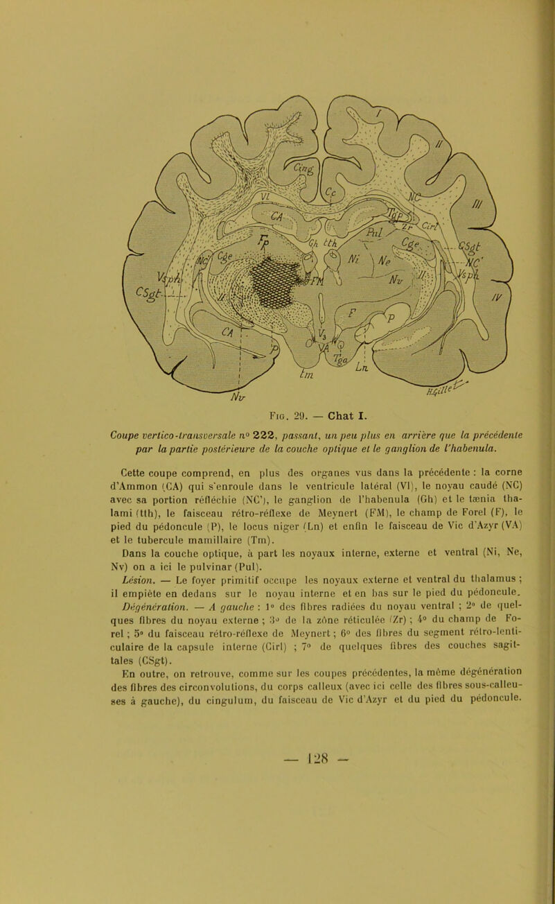 Coupe verlico-transversale n° 222, pansant, un peu plus en arriéré que la précédente par la partie postérieure de la couche optique et le ganglion de l'habenula. Cette coupe comprend, en plus des organes vus dans la précédente : la corne d’Ammon (,CA) qui s'enroule dans le ventricule latéral (VI), le noyau caudé (NC) avec sa portion réfléchie (NC’), le ganglion de l’habenula (Gh) et le tænia tha- lami (tth), le faisceau rétro-réflexe de Meynert (FM), le champ de Forel (F), le pied du pédoncule (P), le locus niger (Ln) et enfin le faisceau de Vie d'Azyr (VA) et le tubercule mamillaire (Tin). Dans la couche optique, à part les noyaux interne, externe et ventral (Ni, Ne, Nv) on a ici le pulvinar (Pul). Lésion. — Le foyer primitif occupe les noyaux externe et ventral du thalamus ; il empiète en dedans sur le noyau interne et en bas sur le pied du pédoncule. Dégénération. — A gauche : 1° des fibres radiées du noyau ventral ; 2° de quel- ques libres du noyau externe ; 3J de la zdne réticulée fZr) ; 4° du champ de Fo- rel ; 5° du faisceau rétro-réflexe de Meynert; 6° des libres du segment rélro-lenti- culaire de la capsule interne (Cirl) ; 7° de quelques libres des couches sagit- tales (CSgt). F.n outre, on retrouve, comme sur les coupes précédentes, la même dégénération des libres des circonvolutions, du corps calleux (avec ici celle des fibres sous-calleu- ses à gauche), du cingulum, du faisceau de Vie d’Azyr et du pied du pédoncule.