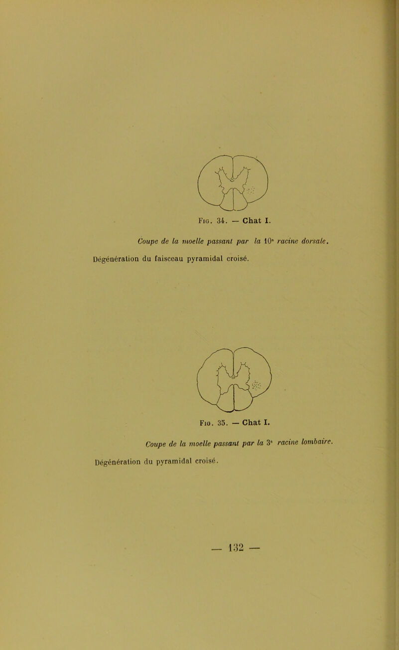 Coupc de la moelle passant par la 10“ Dégénératioa du faisceau pyramidal croisé. Coupe de la moelle passant par la 3' Dégénéralion du pyramidal croisé. racine dorsale. racine lombaire.