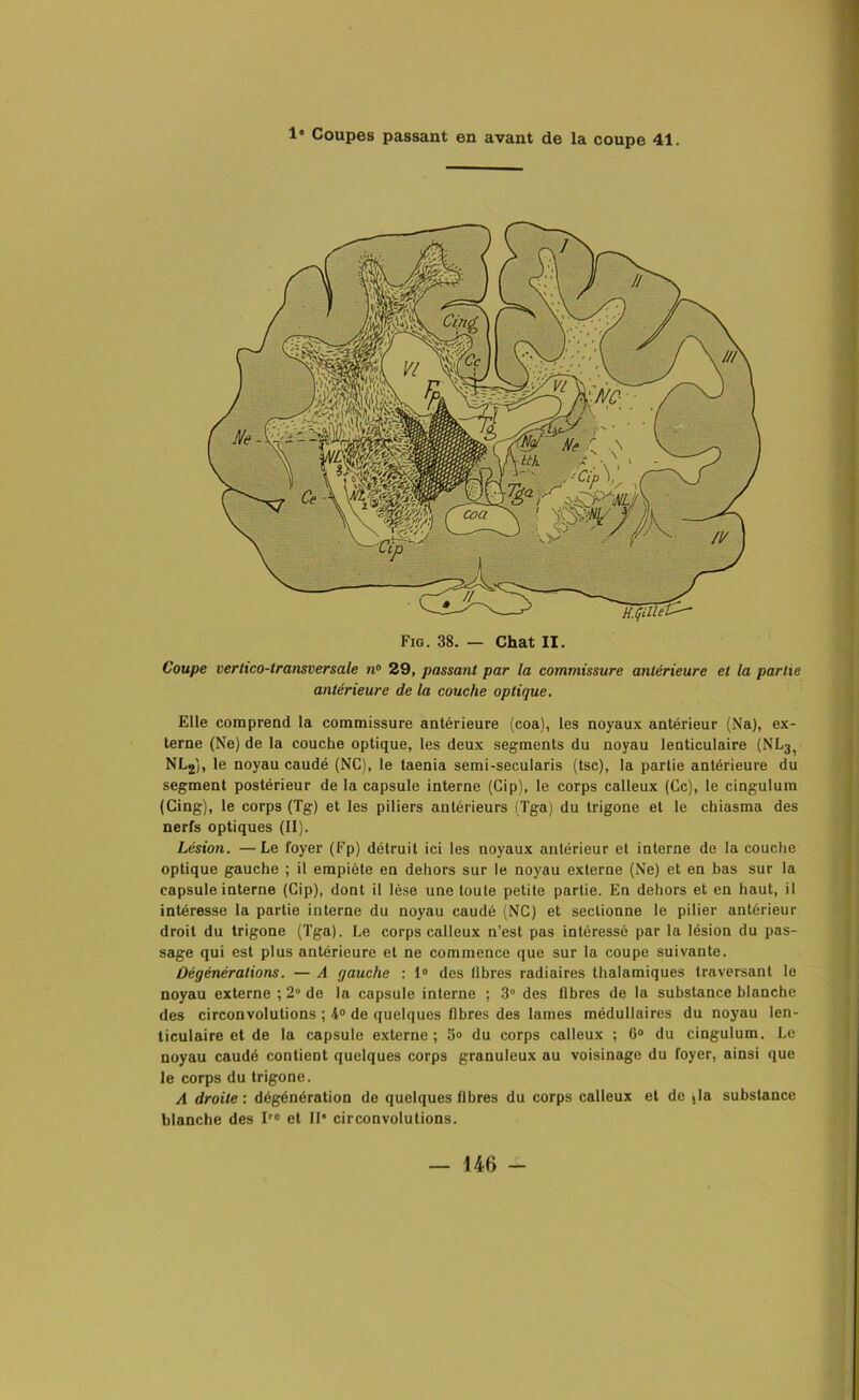 Fig. 38. — Chat II. Coupe vertico-transversale n° 29, passant par la commissure antérieure et la partie antérieure de la couche optique. Elle comprend la commissure antérieure (coa), les noyaux antérieur (Na), ex- terne (Ne) de la couche optique, les deux segments du noyau lenticulaire (NL3> NL2), le noyau caudé (NC), le taenia semi-secularis (tse), la partie antérieure du segment postérieur de la capsule interne (Cip), le corps calleux (Ce), le cingulum (Cing), le corps (Tg) et les piliers antérieurs (Tga) du trigone et le chiasma des nerfs optiques (II). Lésion. —Le foyer (Fp) détruit ici les noyaux antérieur et interne de la couche optique gauche ; il empiète en dehors sur le noyau externe (Ne) et en bas sur la capsule interne (Cip), dont il lèse une toute petite partie. En dehors et en haut, il intéresse la partie interne du noyau caudé (NC) et sectionne le pilier antérieur droit du trigone (Tga). Le corps calleux n’est pas intéressé par la lésion du pas- sage qui est plus antérieure et ne commence que sur la coupe suivante. Ûégénérations. — A gauche : 1° des libres radiaires thalamiques traversant le noyau externe ; 2° de la capsule interne ; 3° des fibres de la substance blanche des circonvolutions ; 4° de quelques fibres des lames médullaires du noyau len- ticulaire et de la capsule externe ; 5» du corps calleux ; 6° du cingulum. Le noyau caudé contient quelques corps granuleux au voisinage du foyer, ainsi que le corps du trigone. A droite : dégénération de quelques fibres du corps calleux et de sla substance blanche des Irc et II circonvolutions.