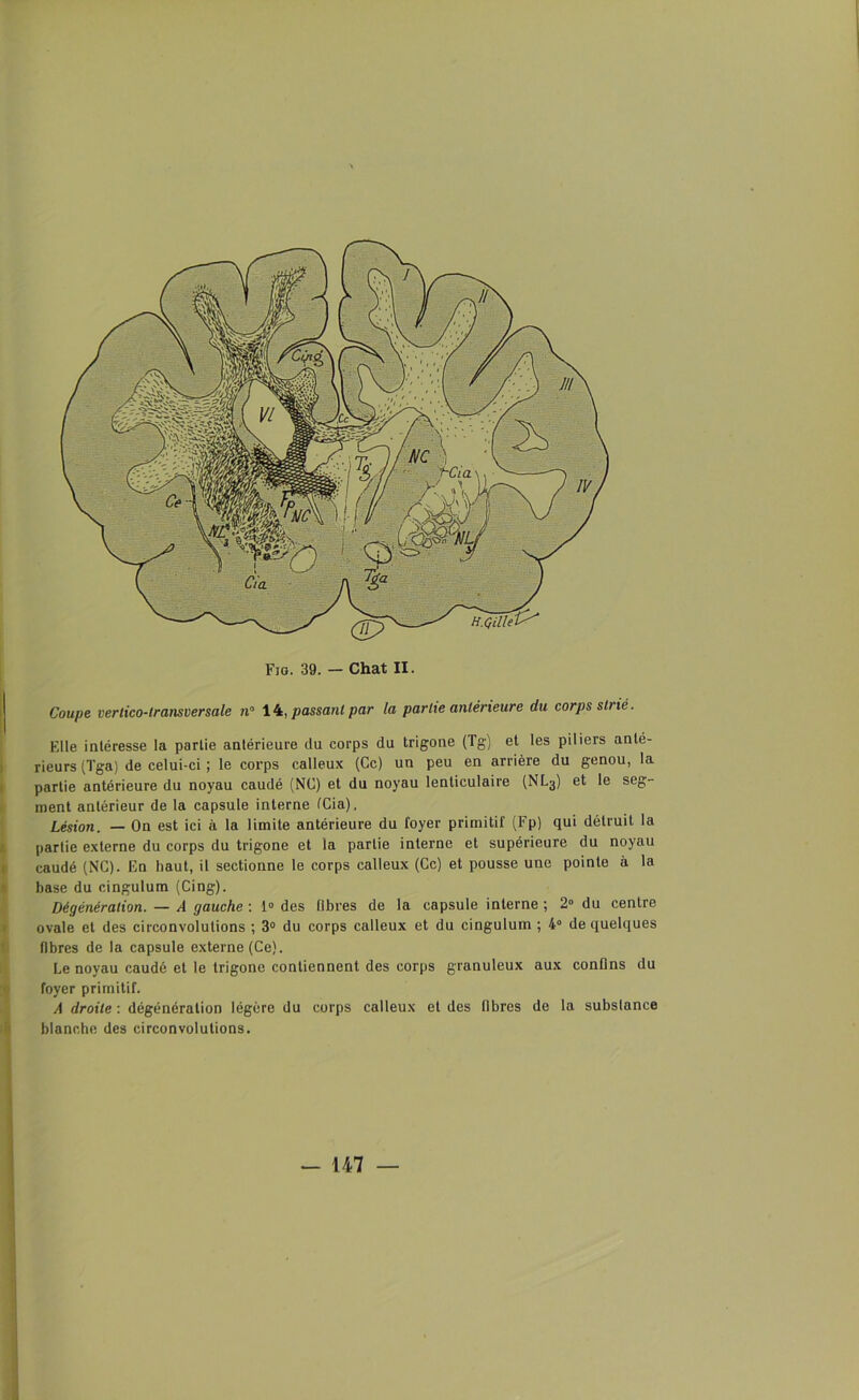 Coupe vertico-transversale n° 14, passant par la partie antérieure du corps strié. Elle intéresse la partie antérieure du corps du trigone (Tg) et les piliers anté- rieurs (Tga) de celui-ci; le corps calleux (Ce) un peu en arrière du genou, la partie antérieure du noyau caudé (NC) et du noyau lenticulaire (NL3) et le seg- ment antérieur de la capsule interne fCia), Lésion. — On est ici à la limite antérieure du foyer primitif (Fp) qui détruit la partie externe du corps du trigone et la partie interne et supérieure du noyau caudé (NC). En haut, il sectionne le corps calleux (Ce) et pousse une pointe à la base du cingulum (Cing). Dégénération. — A gauche: 1° des libres de la capsule interne; 2° du centre ovale et des circonvolutions ; 3° du corps calleux et du cingulum ; 4° de quelques fibres de la capsule externe (Ce). Le noyau caudé et le trigone contiennent des corps granuleux aux confins du foyer primitif. A droite : dégénération légère du corps calleux et des fibres de la substance blanche des circonvolutions.