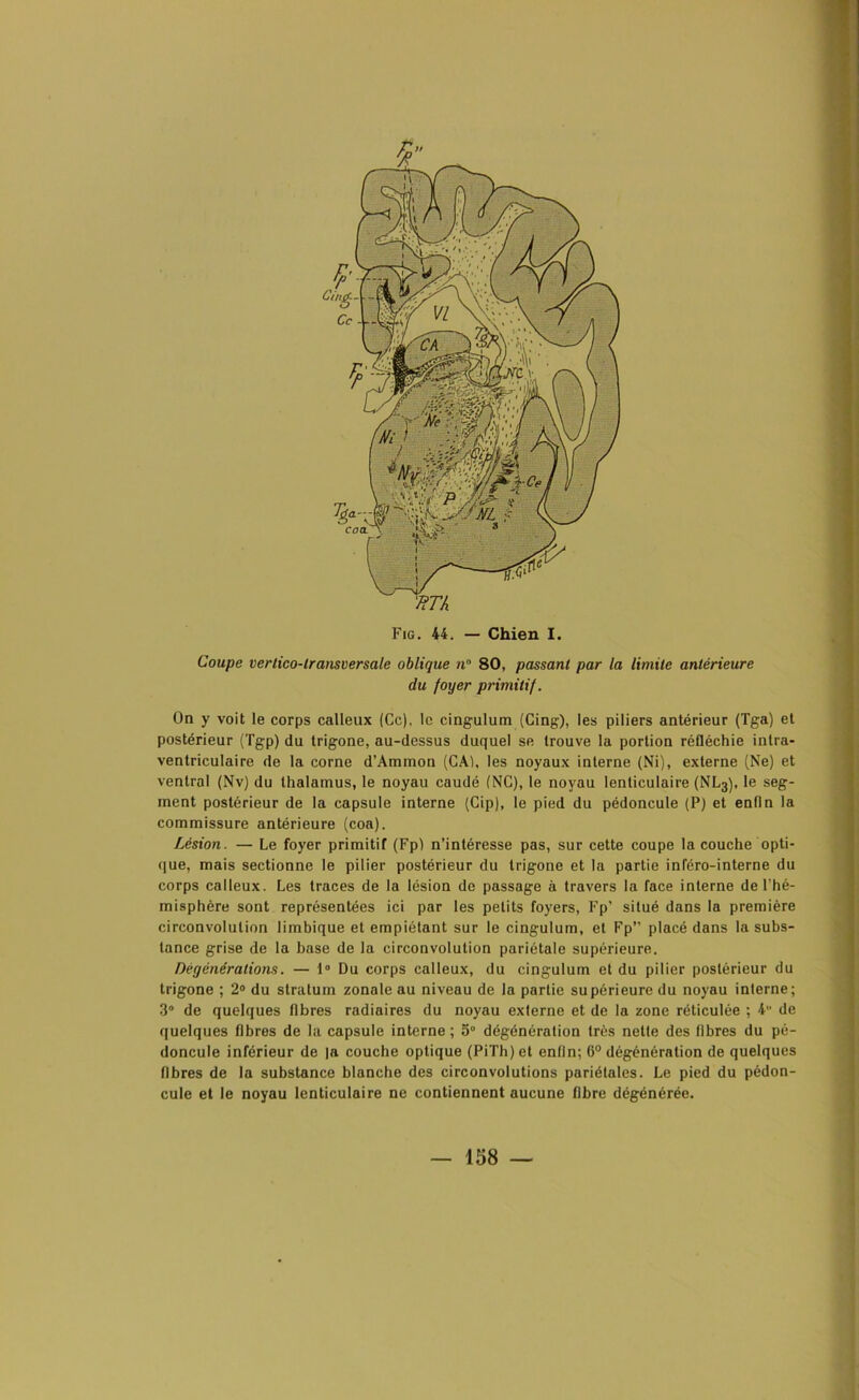 Coupe verlico-lransversate oblique n 80, passant par la limite antérieure du foyer primitif. On y voit le corps calleux (Ce), le cingulum (Cing), les piliers antérieur (Tga) et postérieur (Tgp) du trigone, au-dessus duquel se trouve la portion réfléchie intra- ventriculaire de la corne d’Ammon (CA), les noyaux interne (Ni), externe (Ne) et ventral (Nv) du thalamus, le noyau caudé (NC), le noyau lenticulaire (NL3), le seg- ment postérieur de la capsule interne (Cip), le pied du pédoncule (P) et enfin la commissure antérieure (coa). Lésion. — Le foyer primitif (Fp) n’intéresse pas, sur cette coupe la couche opti- que, mais sectionne le pilier postérieur du trigone et la partie inféro-interne du corps calleux. Les traces de la lésion do passage à travers la face interne de l’hé- misphère sont représentées ici par les petits foyers, Fp’ situé dans la première circonvolution limbique et empiétant sur le cingulum, et Fp” placé dans la subs- tance grise de la base de la circonvolution pariétale supérieure. Dégénérations. — 1° Du corps calleux, du cingulum et du pilier postérieur du trigone ; 2° du stratum zonale au niveau de la partie supérieure du noyau interne; 3° de quelques libres radiaires du noyau externe et de la zone réticulée ; 4 de quelques fibres de la capsule interne ; 5° dégénération très nette des libres du pé- doncule inférieur de |a couche optique (PiTh)et enfin; 6° dégénération de quelques libres de la substance blanche des circonvolutions pariétales. Le pied du pédon- cule et le noyau lenticulaire ne contiennent aucune fibre dégénérée. — 158 —