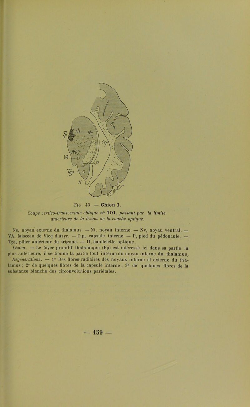 Coupe vertico-lransversale oblique n° 101, passant par la limite antérieure de la lésion de la couche optique. Ne, noyau externe du thalamus. —Ni, noyau interne. — Nv, noyau ventral. — VA, faisceau de Vicq d’Azyr. — Cip, capsule interne. — P, pied du pédoncule. — Tga, pilier antérieur du trigone. — II, bandelette optique. Lésion. — Le foyer primitif thalamique (Fp) est intéressé ici dans sa partie la plus antérieure, il sectionne la partie tout interne du noyau interne du thalamus. Uéqènèralions. — 1» Des libres radiaires des noyaux interne et externe du tha- lamus ; 2° de quelques libres de la capsule interne ; 3° de quelques fibres de la substance blanche des circonvolutions pariétales. — 159 —