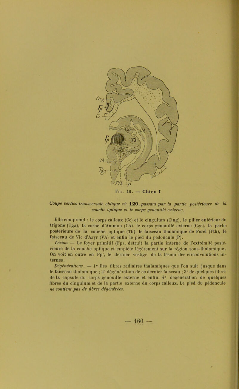 Coupe verlico-lransversale oblique n° 120, passant par la partie postérieure de la couche optique et le corps genouillé externe. Elle comprend : le corps calleux (Ce) et le cingulum (Cing), le pilier antérieur du trigone (Tga), la corne d’Ammon (CAI. le corps genouillé externe (Cge), la partie postérieure de la couche optique (Th), le faisceau thalamique de Forel (Fth), le faisceau de Vie d’Azyr (VA) et enfin le pied du pédoncule (P). Lésion.— Le foyer primitif (Fp), détruit la partie interne de l’extrémité posté- rieure de la couche optique et empiète légèrement sur la région sous-thalamique. On voit en outre en Fp’, le dernier vestige de la lésion des circonvolutions in- ternes. Dégénéralions. — 1° Des fibres radiaires thalamiques que l’on suit jusque dans le faisceau thalamique ; 2° dégénération de ce dernier faisceau ; 3° de quelques fibres de la capsule du corps genouillé externe et enfin, 4° dégénération de quelques fibres du cingulum et de la partie externe du corps calleux. Le pied du pédoncule ne contient pas de fibres dégénérées. — 100