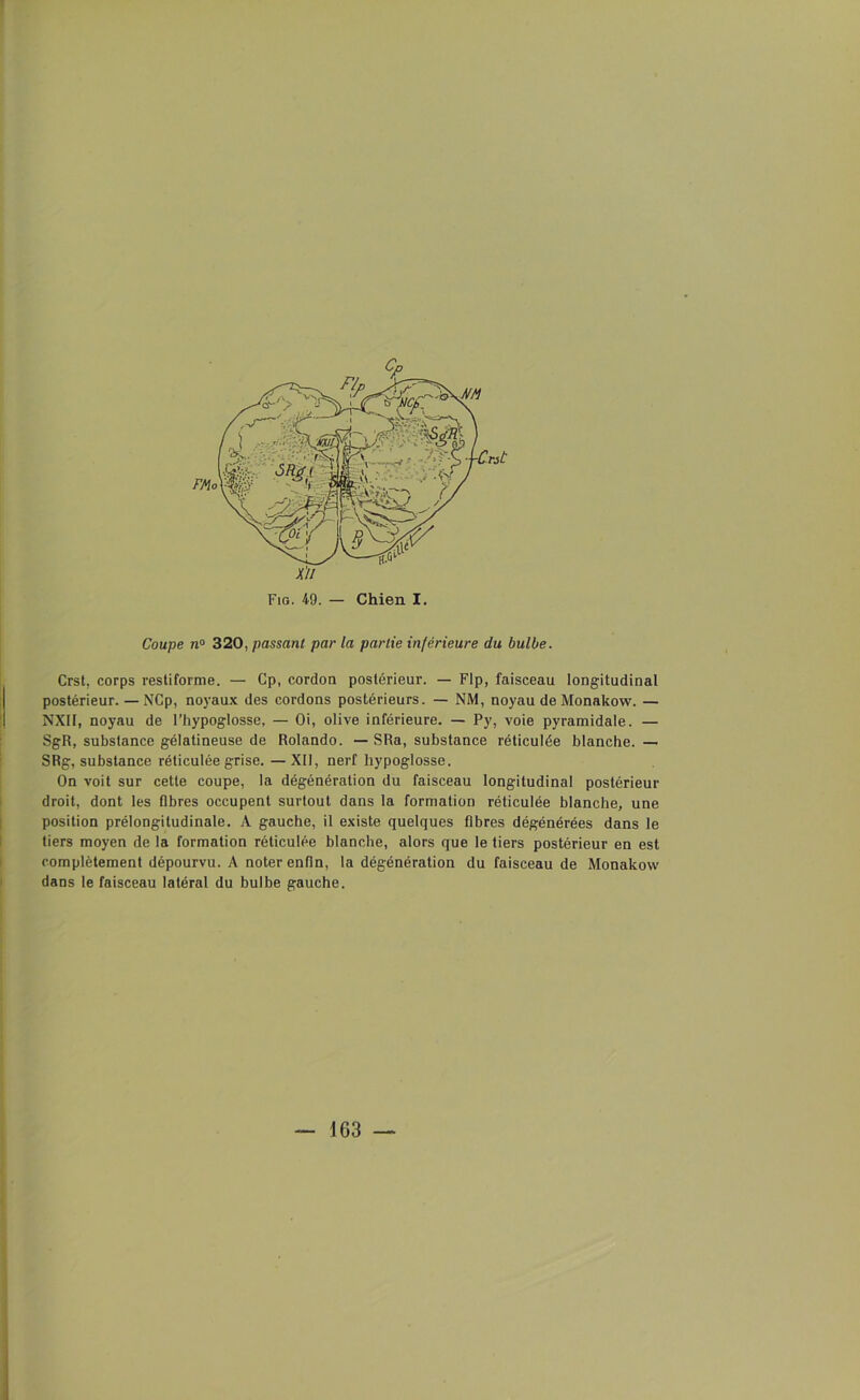 Coupe n° 320, passant par la partie inférieure du bulbe. Crst, corps restiforme. — Cp, cordon postérieur. — Flp, faisceau longitudinal postérieur. — NCp, noyaux des cordons postérieurs. — NM, noyau de Monakow. — NXII, noyau de l’hypoglosse, — Oi, olive inférieure. — Py, voie pyramidale. — SgR, substance gélatineuse de Rolando. — SRa, substance réticulée blanche. — SRg, substance réticulée grise. — XII, nerf hypoglosse. On voit sur cette coupe, la dégénération du faisceau longitudinal postérieur droit, dont les fibres occupent surtout dans la formation réticulée blanche, une position prélongitudinale. A gauche, il existe quelques fibres dégénérées dans le tiers moyen de la formation réticulée blanche, alors que le tiers postérieur en est complètement dépourvu. A noter enfin, la dégénération du faisceau de Monakow dans le faisceau latéral du bulbe gauche. — 163 — ■ •