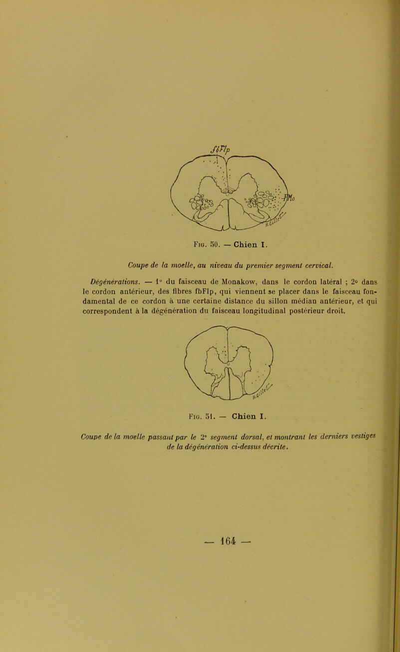 Coupe de la moelle, au niveau du premier segment cervical. Dêgénèrations. — 1° du faisceau de Monakow, dans le cordon latéral ; 2° dans le cordon antérieur, des fibres fbFlp, qui viennent se placer dans le faisceau fon- damental de ce cordon à une certaine distance du sillon médian antérieur, et qui correspondent à la dégénération du faisceau longitudinal postérieur droit. Fig. 51. — Chien I. Coupe de la moelle passant par le 2” segment dorsal, et montrant les derniers vestiges de la dégénéralion ci-dessus décrite. — 164 —
