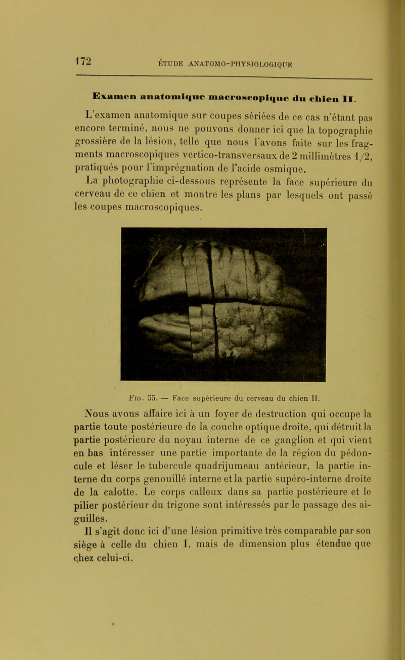 ETUDE ANATOMO-PHYSIOLOGIQUE Examen anatomique macroscopique «lu chien II. L examen anatomique sur coupes sériées de ce cas n’étant pas encore termine, nous no pouvons donner ici que la topographie grossière de la lésion, telle que nous l’avons faite sur les frag- ments macroscopiques vertico-transversaux de 2 millimètres 1/2, pratiqués pour l’imprégnation de l’acide osmique. La photographie ci-dessous représente la face supérieure du cerveau de ce chien et montre les plans par lesquels ont passé les coupes macroscopiques. Fio. 55. — Face supérieure du cerveau du chien II. Nous avons affaire ici à un foyer de destruction qui occupe la partie toute postérieure de la couche optique droite, qui détruit la partie postérieure du noyau interne de ce ganglion et qui vient en bas intéresser une partie importante de la région du pédon- cule et léser le tubercule quadrijumeau antérieur, la partie in- terne du corps genouillé interne et la partie supéro-interne droite de la calotte. Le corps calleux dans sa partie postérieure et le pilier postérieur du trigone sont intéressés par le passage des ai- guilles. 11 s’agit donc ici d’une lésion primitive très comparable par son siège à celle du chien I, mais de dimension plus étendue que chez celui-ci.