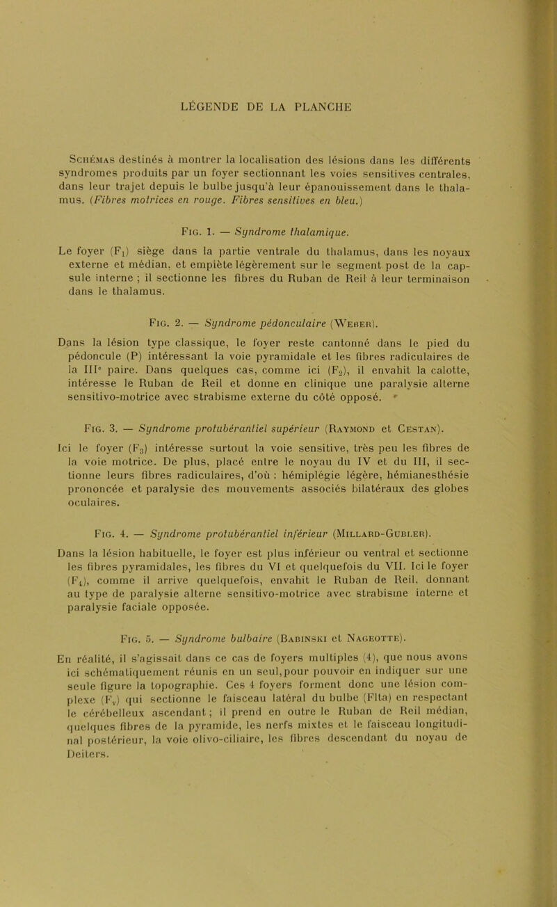 LÉGENDE DE LA PLANCHE Schémas destinés à montrer la localisation des lésions dans les différents syndromes produits par un foyer sectionnant les voies sensitives centrales, dans leur trajet depuis le bulbe jusqu’à leur épanouissement dans le thala- mus. (Fibres motrices en rouge. Fibres sensitives en bleu.) Fig. 1. — Syndrome thalamique. Le foyer (Fj) siège dans la partie ventrale du thalamus, dans les noyaux externe et médian, et empiète légèrement sur le segment post de la cap- sule interne ; il sectionne les fibres du Ruban de Reil à leur terminaison dans le thalamus. Fig. 2. — Syndrome pédonculaire (Weber). Dans la lésion type classique, le foyer reste cantonné dans le pied du pédoncule (P) intéressant la voie pyramidale et les fibres radiculaires de la III0 paire. Dans quelques cas, comme ici (F2), il envahit la calotte, intéresse le Ruban de Reil et donne en clinique une paralysie alterne sensitivo-motrice avec strabisme externe du côté opposé. r Fig. 3. — Syndrome protubérantiel supérieur (Raymond et Cestan). Ici le foyer (F3) intéresse surtout la voie sensitive, très peu les fibres de la voie motrice. De plus, placé entre le noyau du IV et du III, il sec- tionne leurs fibres radiculaires, d’où : hémiplégie légère, hémianesthésie prononcée et paralysie des mouvements associés bilatéraux des globes oculaires. Fig. 4. — Syndrome protubérantiel inférieur (Millard-Gubi.er). Dans la lésion habituelle, le foyer est plus inférieur ou ventral et sectionne les fibres pyramidales, les fibres du VI et quelquefois du VIL Ici le foyer (Fs), comme il arrive quelquefois, envahit le Ruban de Reil, donnant au type de paralysie alterne sensitivo-motrice avec strabisme interne et paralysie faciale opposée. Fig. 5. — Syndrome bulbaire (Babinski et Nageotte). En réalité, il s’agissait dans ce cas de foyers multiples (4), que nous avons ici schématiquement réunis en un seul,pour pouvoir en indiquer sur une seule figure la topographie. Ces 4 foyers forment donc une lésion com- plexe (Fv) qui sectionne le faisceau latéral du bulbe (Flta) en respectant le cérébelleux ascendant; il prend en outre le Ruban de Reil médian, quelques fibres de la pyramide, les nerfs mixtes et le faisceau longitudi- nal postérieur, la voie olivo-ciliairc, les fibres descendant du noyau de Deiters.