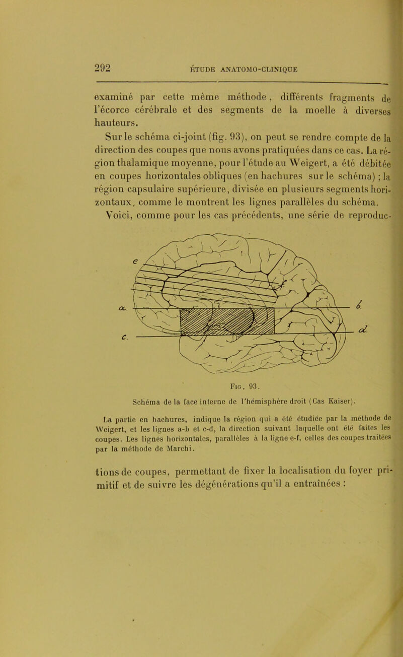 examiné par cette même méthode, différents fragments de l’écorce cérébrale et des segments de la moelle à diverses hauteurs. Sur le schéma ci-joint (fig. 93), on peut se rendre compte de la direction des coupes que nous avons pratiquées dans ce cas. La ré- gion thalamique moyenne, pour l’étude au Weigert, a été débitée en coupes horizontales obliques (en hachures su rie schéma) ; la région capsulaire supérieure, divisée en plusieurs segments hori- zontaux, comme le montrent les lignes parallèles du schéma. Voici, comme pour les cas précédents, une série de reproduc- Fig. 93. Schéma delà face interne de l'hémisphère droit (Cas Kaiser). La partie en hachures, indique la région qui a été étudiée par la méthode de Weigert, et les lignes a-b et c-d, la direction suivant laquelle ont été faites les coupes. Les lignes horizontales, parallèles à la ligne e-f, celles des coupes traitées par la méthode de Marchi. tionsde coupes, permettant de fixer la localisation du foyer pri- mitif et de suivre les dégénérations qu’il a entraînées :