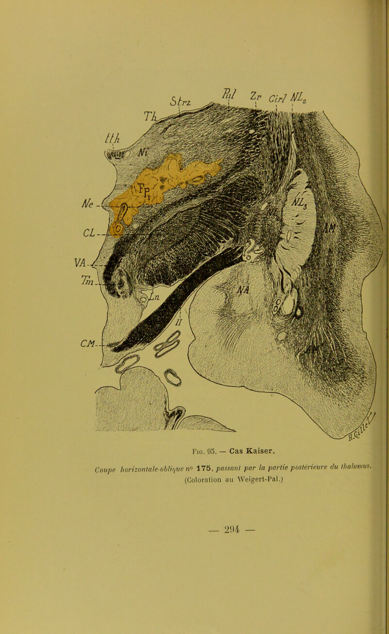 Coupe horizontale-oblique n° 175, passant par la partie postérieure du thalamus. (Coloration uu Weigert-Pal.) CM Z r Cirl iïL, CL-