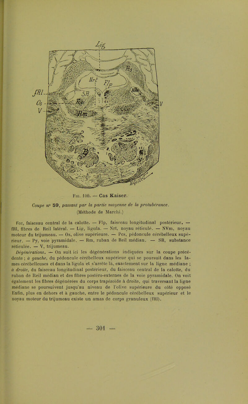 Coupe il0 59, passant par la partie moyenne de la protubérance. (Méthode de Marchi.) Fcc, faisceau central de la calotte. — Flp, faisceau longitudinal postérieur. — fRI, fibres de Reil latéral. — Lig, ligula. — Nrt, noyau réticulé. — NVm, noyau moteur du trijumeau. — Os, olive supérieure. — Pcs, pédoncule cérébelleux supé- rieur. — Py, voie pyramidale. — Rm, ruban de Reil médian. — SR, substance réticulée. — V, trijumeau. Dêgènèralions. — On suit ici les dégénérations indiquées sur la coupe précé- dente ; u gauche, du pédoncule cérébelleux supérieur qui se poursuit dans les la- mes cérébelleuses et dans la ligula et s’arrête là, exactement sur la ligne médiane ; « droite, du faisceau longitudinal postérieur, du faisceau central de la calotte, du ruban de Reil médian et des fibres postéro-externes de la voie pyramidale. On voit également les fibres dégénérées du corps trapézoïde à droite, qui traversant la ligne médiane se poursuivent jusqu’au niveau de l’olive supérieure du côté opposé Enfin, plus en dehors et à gauche, entre le pédoncule cérébelleux supérieur et le noyau moteur du trijumeau existe un amas de corps granuleux (fRI).