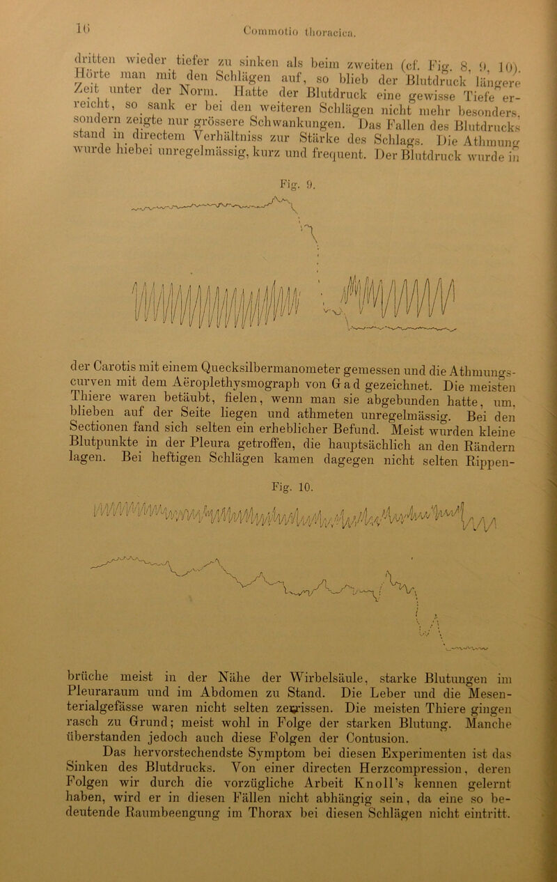 n> dntten wieder tiefer zu sinken als beim zweiten (cf. Fie 8 0 101 llurte inan mit den Schlägen auf, so blieb der Blutdruck längere /eit untei der Norm. Hatte der Blutdruck eine gewisse Tiefe er- reicht, so sank er bei den weiteren Schlägen nicht mehr besonders sondern zeigte nur grössere Schwankungen. Das Fallen des Blutdrucks stand in directem Verhältmss zur Stärke des Schlags. Die Athmuncr wurde hiebei unregelmässig, kurz und frequent. Der Blutdruck wurde in Fig. 9. der Carotis mit einem Quecksilbermanometer gemessen und die Athmuno-s- curven mit dem Aeroplethysmograph von Gad gezeichnet. Die meisfen Thiere waren betäubt, fielen, wenn man sie abgebunden hatte, um, blieben auf der Seite liegen und athmeten unregelmässig. Bei den Sectionen fand sich selten ein erheblicher Befund. Meist wurden kleine Blutpunkte in der Pleura getroffen, die hauptsächlich an den Rändern lagen. Bei heftigen Schlägen kamen dagegen nicht selten Rippen- Fig. 10. i W\A briiche meist in der Nähe der Wirbelsäule, starke Blutungen im Pleuraraum und im Abdomen zu Stand. Die Leber und die Mesen- terialgefässe waren nicht selten zerrissen. Die meisten Thiere gingen rasch zu Grund; meist wohl in Folge der starken Blutung. Manche überstanden jedoch auch diese Folgen der Contusion. Das hervorstechendste Symptom bei diesen Experimenten ist das Sinken des Blutdrucks. Von einer directen Herzcompression, deren Folgen wir durch die vorzügliche Arbeit Ivnoll’s kennen gelernt haben, wird er in diesen Fällen nicht abhängig sein, da eine so be- deutende Raumbeengung im Thorax bei diesen Schlägen nicht eintritt.