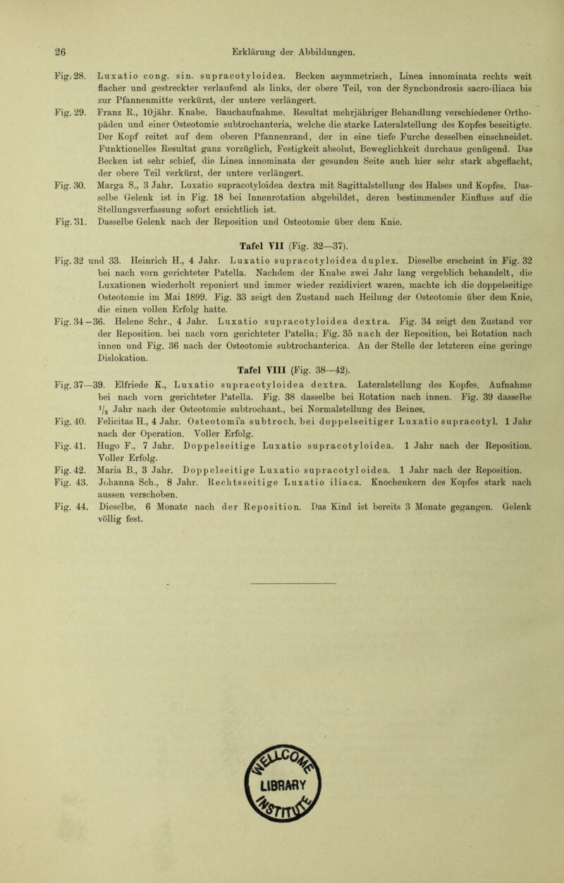 Fig. 28. Fig. 29. Fig. 30. Fig. 31. Luxatio cong. sin. supracotyloidea. Becken asymmetrisch, Linea innominata rechts weit flacher und gestreckter verlaufend als links, der obere Teil, von der Synchondrosis sacro-iliaca bis zur Pfannenmitte verkürzt, der untere verlängert. Franz R., lOjähr. Knabe. Bauchaufnahme. Resultat mehrjähriger Behandlung verschiedener Ortho- päden und einer Osteotomie subtrochanteria, welche die starke Lateralstellung des Kopfes beseitigte. Der Kopf reitet auf dem oberen Pfannenrand, der in eine tiefe Furche desselben einschneidet. Funktionelles Resultat ganz vorzüglich, Festigkeit absolut, Beweglichkeit durchaus genügend. Das Becken ist sehr schief, die Linea innominata der gesunden Seite auch hier sehr stark abgeflacht, der obere Teil verkürzt, der untere verlängert. Marga S., 3 Jahr. Luxatio supracotyloidea dextra mit Sagittalstellung des Halses und Kopfes. Das- selbe Gelenk ist in Fig. 18 bei Innenrotation abgebildet, deren bestimmender Einfluss auf die Stellungsverfassung sofort ersichtlich ist. Dasselbe Gelenk nach der Reposition und Osteotomie über dem Knie. Tafel VII (Fig. 32—37). Fig. 32 und 33. Heinrich H., 4 Jahr. Luxatio supracotyloidea duplex. Dieselbe erscheint in Fig. 32 bei nach vorn gerichteter Patella. Nachdem der Knabe zwei Jahr lang vergeblich behandelt, die Luxationen wiederholt reponiert und immer wieder rezidiviert waren, machte ich die doppelseitige Osteotomie im Mai 1899. Fig. 33 zeigt den Zustand nach Heilung der Osteotomie über dem Knie, die einen vollen Erfolg hatte. Fig. 34—36. Helene Sehr., 4 Jahr. Luxatio supracotyloidea dextra. Fig. 34 zeigt den Zustand vor der Reposition, bei nach vorn gerichteter Patella; Fig. 35 nach der Reposition, bei Rotation nach innen und Fig. 36 nach der Osteotomie subtroehanterica. An der Stelle der letzteren eine geringe Dislokation. Tafel VIII (Fig. 38—42). Fig. 37—39. Elfriede K., Luxatio supracotyloidea dextra. Lateralstellung des Kopfes. Aufnahme bei nach vorn gerichteter Patella. Fig. 38 dasselbe bei Rotation nach innen. Fig. 39 dasselbe */g Jahr nach der Osteotomie subtrochant., bei Normalstellung des Beines. Fig. 40. Felicitas H., 4 Jahr. Osteotomfa subtroch. bei doppelseitiger Luxatio supracotyl. 1 Jahr nach der Operation. Voller Erfolg. Fig. 41. Hugo F., 7 Jahr. Doppelseitige Luxatio supracotyloidea. 1 Jahr nach der Reposition. Voller Erfolg. Fig. 42. Maria B., 3 Jahr. Doppelseitige Luxatio supracotyloidea. 1 Jahr nach der Reposition. Fig. 43. Johanna Sch., 8 Jahr. Rechtsseitige Luxatio iliaca. Knochenkem des Kopfes stark nach aussen verschoben. Fig. 44. Dieselbe. 6 Monate nach der Reposition. Das Kind ist bereits 3 Monate gegangen. Gelenk völlig fest.