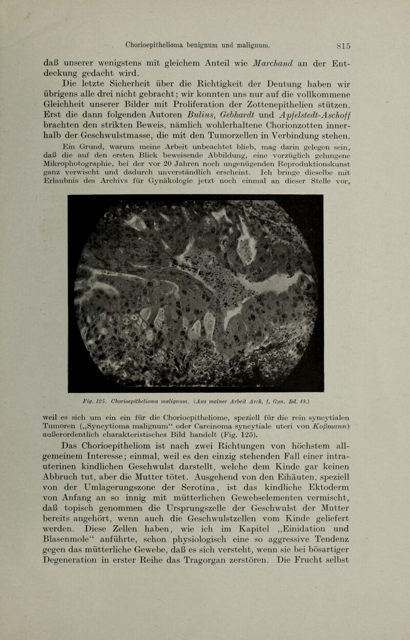 daß unserer wenigstens mit gleichem Anteil wie Marchand an der Ent- deckung gedacht wird. Die letzte Sicherheit über die Richtigkeit der Deutung haben wir übrigens alle drei nicht gebracht; wir konnten uns nur auf die vollkommene Gleichheit unserer Bilder mit Proliferation der Zottenepithelien stützen. Erst die dann folgenden Autoren Bulius, Gebhardt und Apjelstedt-A schof/ brachten den strikten Beweis, nämlich wohlerhaltene Chorionzotten inner- halb der Geschwulstmasse, die mit den Tumorzellen in Verbindung stehen. Ein Grund, warum meine Arbeit unbeachtet blieb, mag darin gelegen sein, daß die auf den ersten Blick beweisende Abbildung, eine vorzüglich gelungene Mikrophotographie, bei der vor 20 Jahren noch ungenügenden Reproduktionskunst ganz verwischt und dadurch unverständlich erscheint. Ich bringe dieselbe mit Erlaubnis des Archivs für Gynäkologie jetzt noch einmal an dieser Stelle vor. Fig. 125. Chorioepithelioma malignum. (Aus meiner Arbeit Arch. /. Gyn. Brl. 18.) weil es sich um ein ein für die Chorioepitheliome, speziell für die rein syncytialen Tumoren (,,Syncytioma malignum“ oder Carcinoma syncytiale uteri von Koßmann) außerordentlich charakteristisches Bild handelt (Fig. 125). Das Chorioepitheliom ist nach zwei Richtungen von höchstem all- gemeinem Interesse; einmal, weil es den einzig stehenden Fall einer intra- uterinen kindlichen Geschwulst darstellt, welche dem Kinde gar keinen Abbruch tut, aber die Mutter tötet. Ausgehend von den Eihäuten, speziell von der Umlagerungszone der Serotina, ist das kindliche Ektoderm von Anfang an so innig mit mütterlichen Gewebselementen vermischt, daß topisch genommen die Ursprungszelle der Geschwulst der Mutter bereits angehört, wenn auch die Geschwulstzellen vom Kinde geliefert werden. Diese Zellen haben, wie ich im Kapitel „Einidation und Blasenmole“ anführte, schon physiologisch eine so aggressive Tendenz gegen das mütterliche Gewebe, daß es sich versteht, wenn sie bei bösartiger Degeneration in erster Reihe das Tragorgan zerstören. Die Frucht selbst
