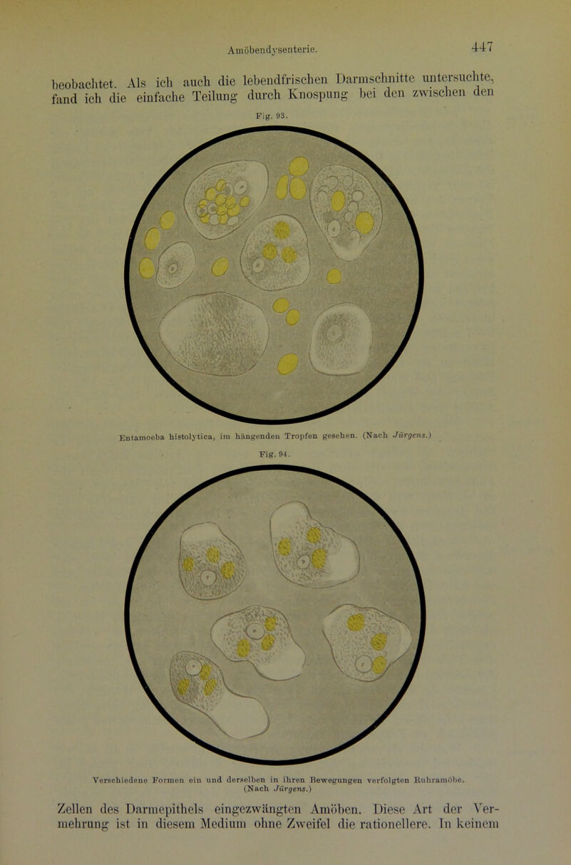 beobachtet Als ich auch die lebendfrischen Darmschnitte untersuchte, fand ich die einfache Teilung durch Knospung bei den zwischen den Fig. 93. Entamoeba histolytica, im hängenden Tropfen gesehen. (Nach Jürgens.) Fig. 94. Verschiedene Formen ein und derselben in ihren Bewegungen verfolgten Ruhramöbe. (Nach Jürgens.) Zellen des Darmepithels eingezwängten Amöben. Diese Art der Ver- mehrung ist in diesem Medium ohne Zweifel die rationellere. In keinem