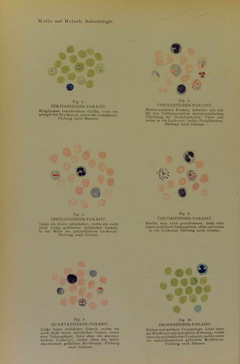 Kölle und Hetsch, Bakteriologie. Fig. 1. TERTIANFIEBER-PARASIT. Ringformen verschiedener Größe, oben ein getüpfelter Erythrocyt, unten ein Lyrophocyt. Färbung nach Manson. Fig. 3. TERTIANFIEBER-PARASIT. Halberwachsene Formen, teilweise mit der für den Tertianparasiten charakteristischen Tüpfelung der Blutkörperchen. Oben und unten je ein Leukocyt, rechts Blutplättchen. Färbung nach Giemsa. c ffi . '»'M -• f Fig. 5. TERTIA NFIEBKR -PA R ASIT. Links ein freier männlicher, rechts ein noch nicht fertig gebildeter weiblicher Gamet, in der Mitte ein polynukleärer Leukocyt. Färbung nach Giemsa. Fig. 6. TERTIANFIEBER-PARASIT. Rechts eine noch geschlossene, links eine schon zerfallene Teilungsform, oben und unten je ein Leukocyt. Färbung nach Giemsa. Fig. 3. QUARTANFIEBER-PARASIT. Links freier weiblicher Gamet, rechts ein noch nicht freier männlicher Gamet, unten eine Teilungsfigur, links oben ein mononu- kleärer Leukocyt, rechts oben ein meta- chromatisch gefärbter Erythrocyt. Färbung nach Giemsa. Fig. 10. TROPENFIEBER-PARASIT. Kleine und mittlere Tropenringe. Links oben ein Erythrocyt mit basophiler Körnung, rechts oben ein polynukleärer Leukocyt, rechts unten ein metachromatisch gefärbter Erythrocyt. Färbung nach Manson.