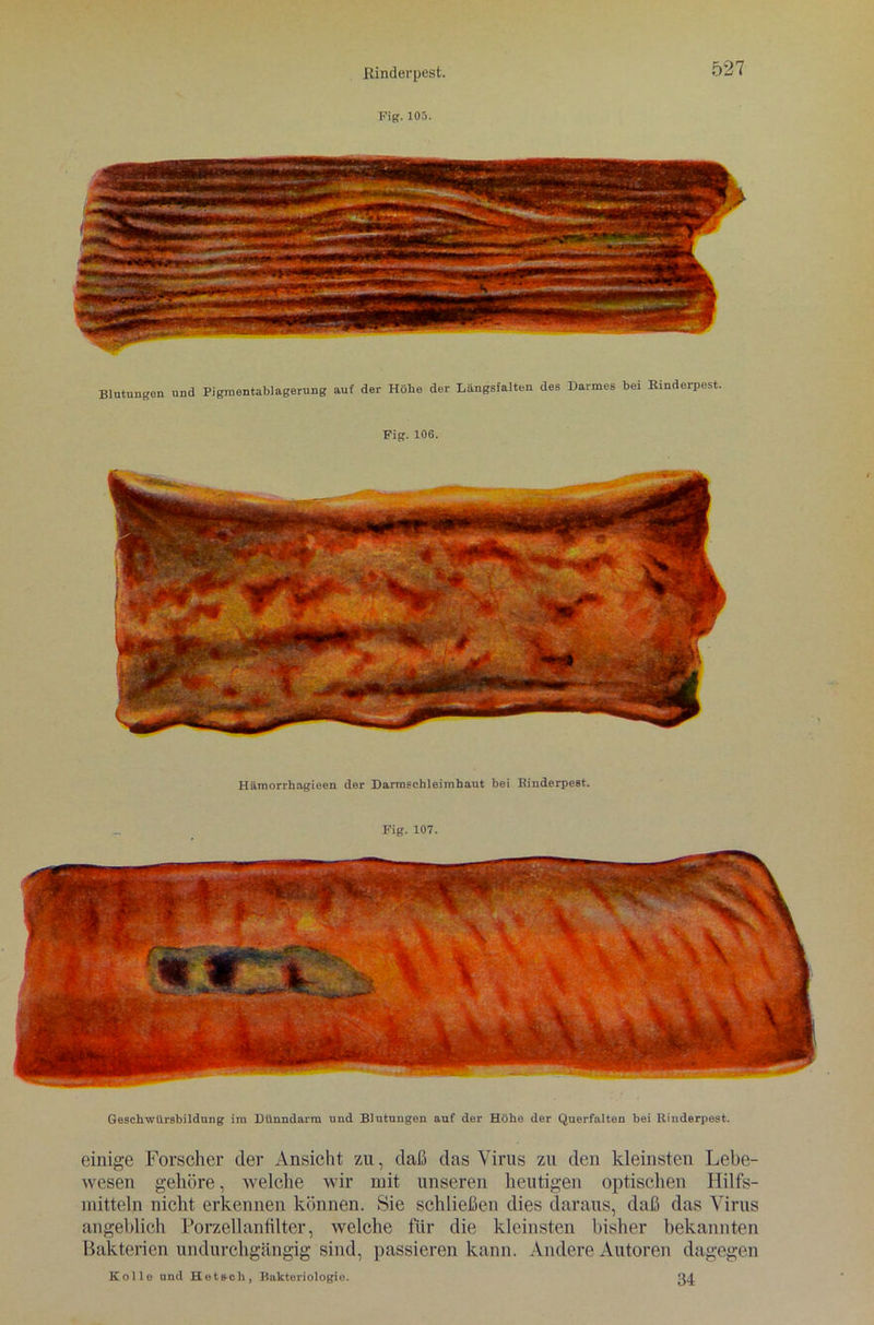 Fig. 105. Blutungon und Pigmentablagerung auf der Höhe der Längsfalten des Darmes bei Kinderpest. Fig. 106. Hämorrhagieen der Darmschleimhaut bei Rinderpest. Fig. 107. Geschwürsbildung im Dünndarm und Blutungen auf der Höhe der Querfalten hei Rinderpest. einige Forscher der Ansicht zu, daß das Virus zu den kleinsten Lebe- wesen gehöre, welche wir mit unseren heutigen optischen Hilfs- mitteln nicht erkennen können. Sie schließen dies daraus, daß das Virus angeblich Porzellanfilter, welche für die kleinsten bisher bekannten Bakterien undurchgängig sind, passieren kann. Andere Autoren dagegen Rolle und Het&ch, Bakteriologio. 34