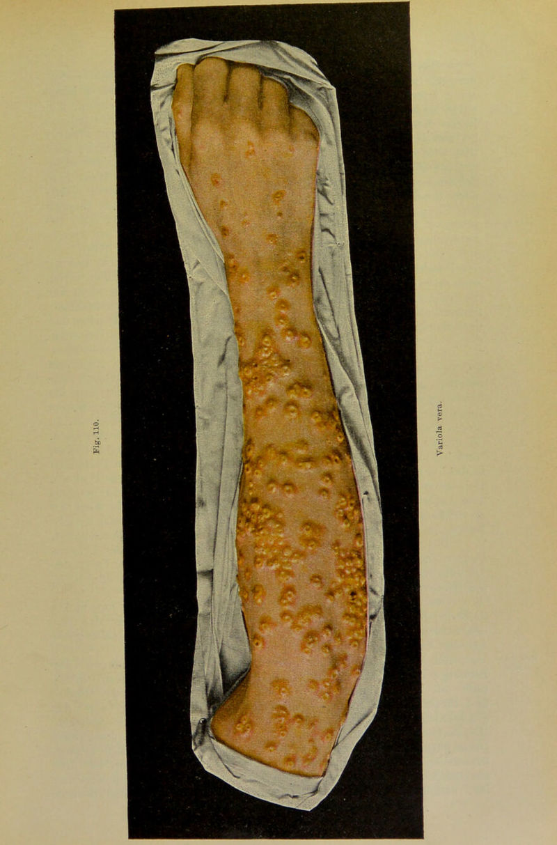 Fig. 110. Yariola vera.