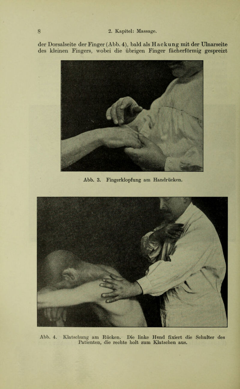 der Dorsalseite der Finger (Abb. 4), bald als Hackung mit der Ulnarseite des kleinen Fingers, wobei die übrigen Finger fächerförmig gespreizt Abb. 3. Fingerklopfung am Handrücken. Abb. 4. Klatschung am Rücken. Die linke H'cnd fixiert die Schulter des Patienten, die rechte holt zum Klatschen aus.