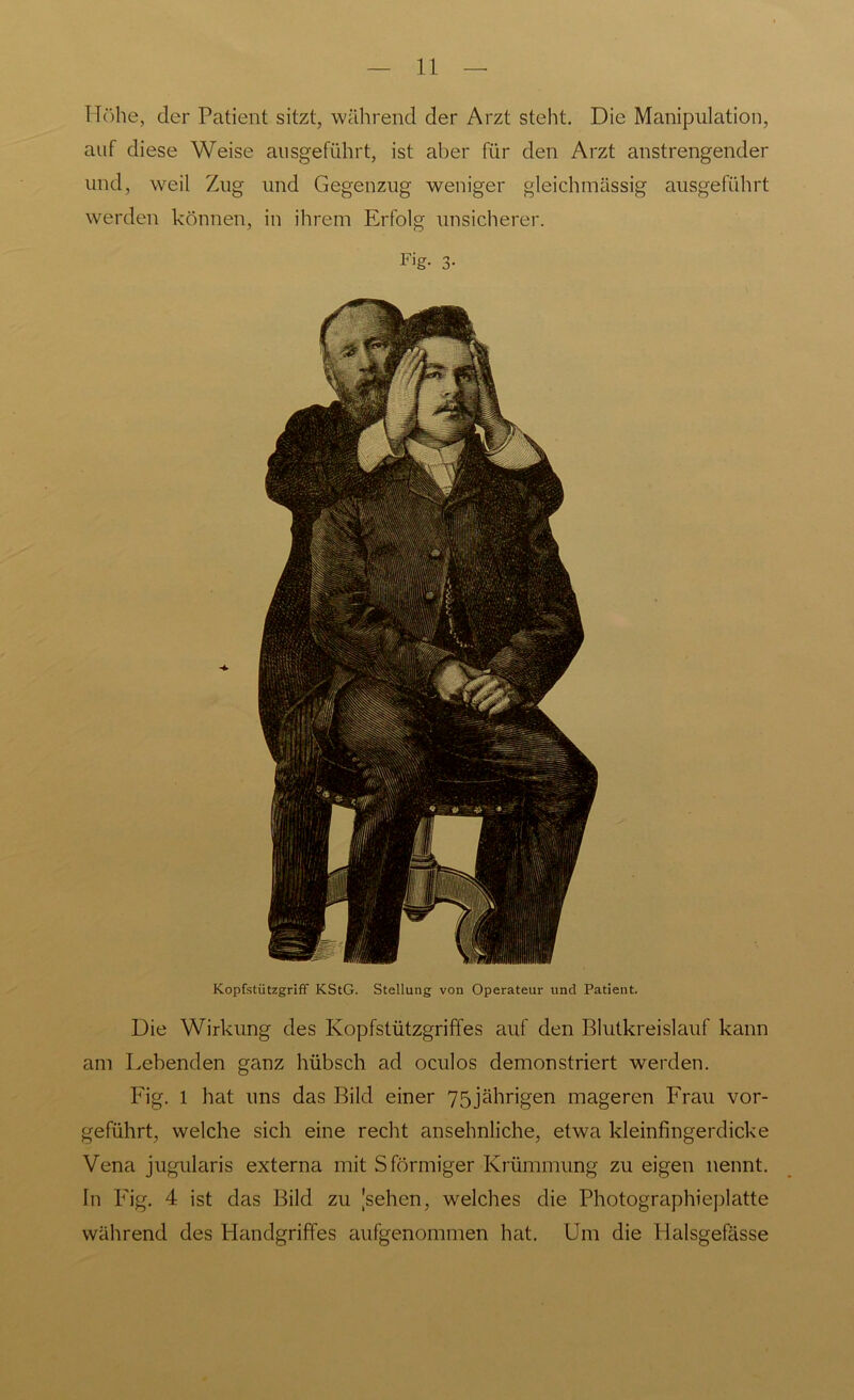 Höhe, der Patient sitzt, während der Arzt steht. Die Manipulation, auf diese Weise ausgeführt, ist aber für den Arzt anstrengender und, weil Zug und Gegenzug weniger gleichmässig ausgeführt werden können, in ihrem Erfolg unsicherer. Fig. 3- Kopfstützgriff KStG. Stellung von Operateur und Patient. Die Wirkung des Kopfstützgriffes auf den Blutkreislauf kann am Lebenden ganz hübsch ad oculos demonstriert werden. Fig. 1 hat uns das Bild einer 75jährigen mageren Frau vor- geführt, welche sich eine recht ansehnliche, etwa kleinfingerdicke Vena jugularis externa mit S förmiger Krümmung zu eigen nennt. In Fig. 4 ist das Bild zu [sehen, welches die Photographieplatte während des Handgriffes aufgenommen hat. Um die Plalsgefässe