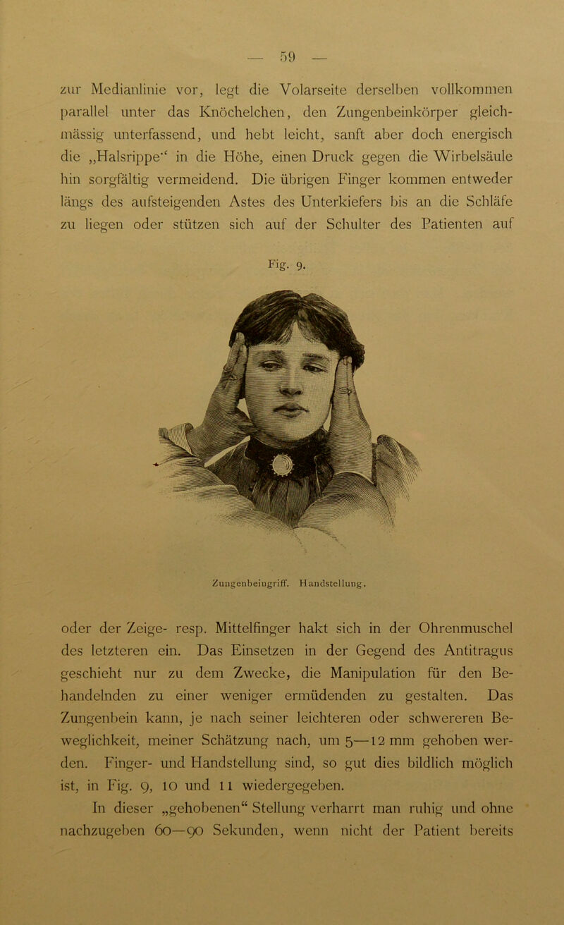 zur Medianlinie vor, legt die Volarseite derselben vollkommen parallel unter das Knöchelchen, den Zungenbeinkörper gleich- massig unterfassend, und hebt leicht, sanft aber doch energisch die „Halsrippe‘‘ in die Höhe, einen Druck gegen die Wirbelsäule hin sorgfältig vermeidend. Die übrigen Finger kommen entweder längs des aufsteigenden Astes des Unterkiefers bis an die Schläfe zu liegen oder stützen sich auf der Schulter des Patienten auf Fig. 9. Zungenbeingriff. Handstellung. oder der Zeige- resp. Mittelfinger hakt sich in der Ohrenmuschel des letzteren ein. Das Einsetzen in der Gegend des Antitragus geschieht nur zu dem Zwecke, die Manipulation für den Be- handelnden zu einer weniger ermüdenden zu gestalten. Das Zungenbein kann, je nach seiner leichteren oder schwereren Be- weglichkeit, meiner Schätzung nach, um 5—12 mm gehoben wer- den. Finger- und Handstellung sind, so gut dies bildlich möglich ist, in Fig. 9, 10 und 11 wiedergegeben. In dieser „gehobenen“ Stellung verharrt man ruhig und ohne nachzugeben 60—90 Sekunden, wenn nicht der Patient bereits