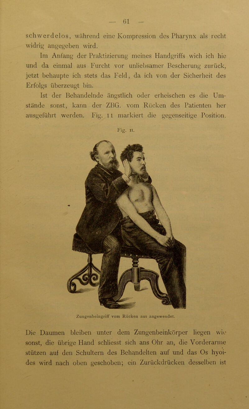 schwerdelos, während eine Kompression des Pharynx als recht widrig angegeben wird. Im Anfang der Praktizierung meines Handgriffs wich ich hie und da einmal aus Furcht vor unliebsamer Bescherung zurück, jetzt behaupte ich stets das Feld, da ich von der Sicherheit des Erfolgs überzeugt bin. Ist der Behandelnde ängstlich oder erheischen es die Um- stände sonst, kann der ZBG. vom Rücken des Patienten her ausgeführt werden. Fig. 11 markiert die gegenseitige Position. Fig. ii. Zungenbeingriff vom Rücken aus angewendet. Die Daumen bleiben unter dem Zungenbeinkörper liegen wie sonst, die übrige Hand schliesst sich ans Ohr an, die Vorderarme stützen auf den Schultern des Behandelten auf und das Os hyoi- des wird nach oben geschoben; ein Zurückdrücken desselben ist