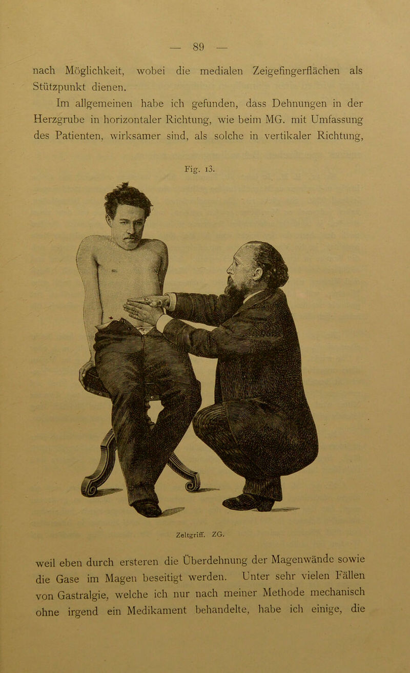 nach Möglichkeit, wobei die medialen Zeigefingerflächen als Stützpunkt dienen. Im allgemeinen habe ich gefunden, dass Dehnungen in der Herzgrube in horizontaler Richtung, wie beim MG. mit Umfassung des Patienten, wirksamer sind, als solche in vertikaler Richtung, Fig. i3. Zeltgriff. ZG. weil eben durch ersteren die Überdehnung der Magenwände sowie die Gase im Magen beseitigt werden. Unter sehr vielen Fällen von Gastralgie, welche ich nur nach meiner Methode mechanisch ohne irgend ein Medikament behandelte, habe ich einige, die