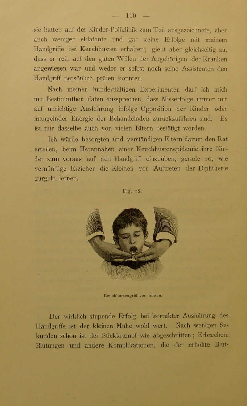 sie hätten auf der Kinder-Poliklinik zum Teil ausgezeichnete, aber auch weniger eklatante und gar keine Erfolge mit meinem Handgriffe bei Keuchhusten erhalten; giebt aber gleichzeitig zu, dass er rein auf den guten Willen der Angehörigen der Kranken angewiesen war und weder er selbst noch seine Assistenten den Handgriff persönlich prüfen konnten. Nach meinen hundertfältigen Experimenten darf ich mich mit Bestimmtheit dahin aussprechen, dass Misserfolge immer nur auf unrichtige Ausführung infolge Opposition der Kinder oder mangelnder Energie der Behandelnden zurückzuführen sind. Es ist mir dasselbe auch von vielen Eltern bestätigt worden. Ich würde besorgten und verständigen Eltern darum den Rat erteilen, beim Herannahen einer Keuchhustenepidemie ihre Kin- der zum voraus auf den Handgriff einzuüben, gerade so, wie vernünftige Erzieher die Kleinen vor Auftreten der Diphtherie gurgeln lernen. Fig. iS. Keuchhustengriff von hinten. Der wirklich stupende Erfolg bei korrekter Ausführung des Handgriffs ist der kleinen Mühe wohl wert. Nach wenigen Se- kunden schon ist der Stickkrampf wie abgeschnitten; Erbrechen, Blutungen und andere Komplikationen, die der erhöhte Blut-