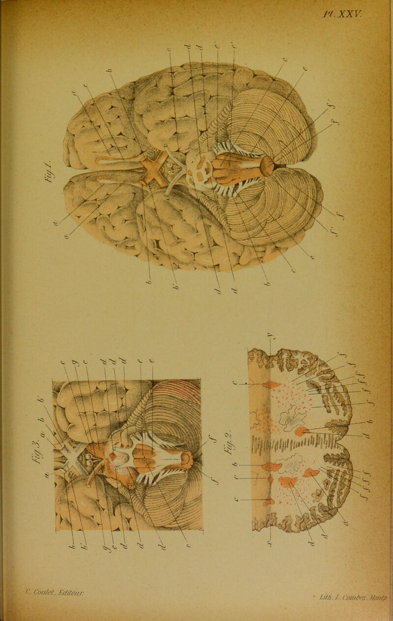 /'/. XXV Coalet, Editeur /-ilh /. Comâtv. ïfoidp ! “ï ^ \s v