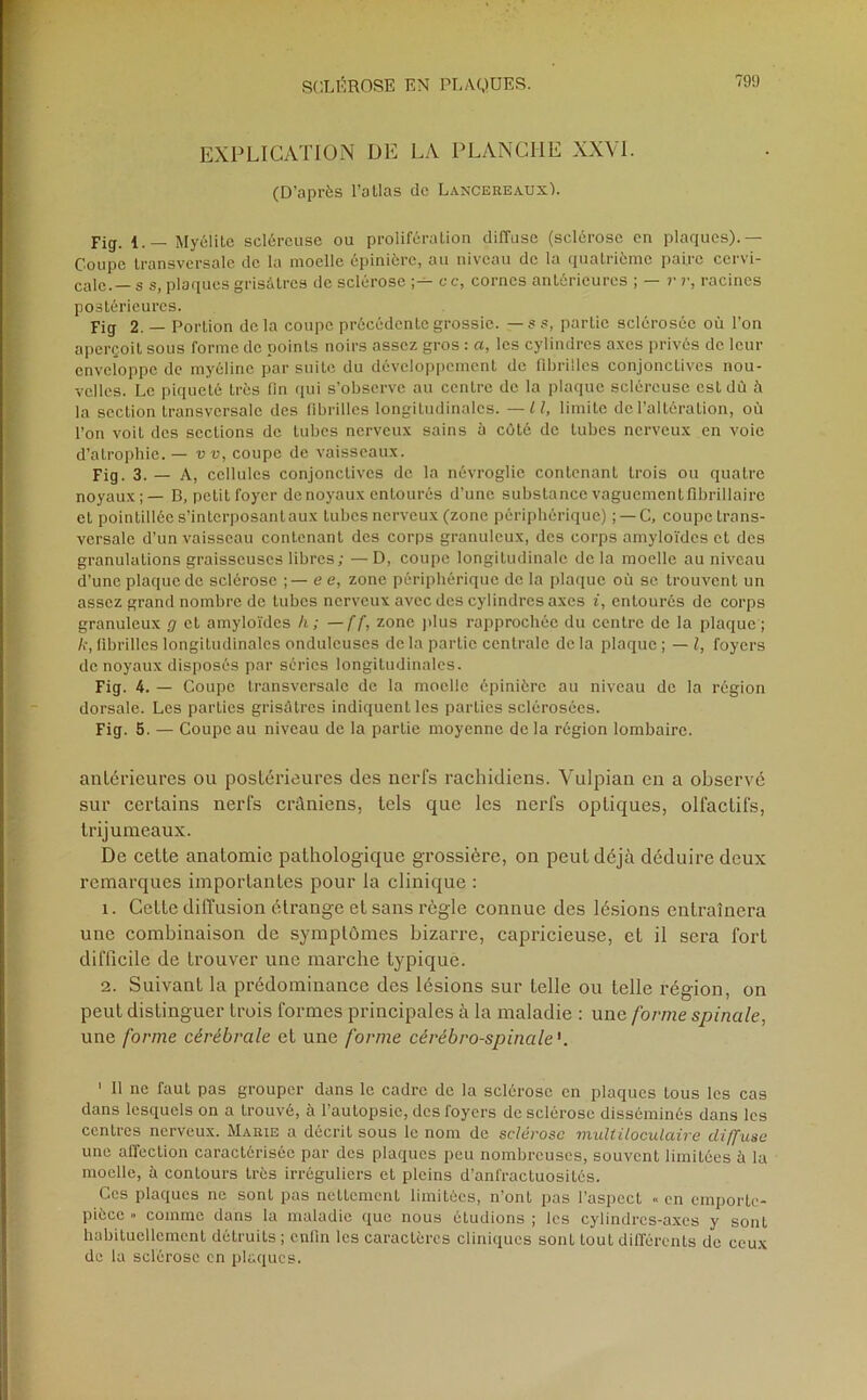 EXPLICATION DE LA PLANCHE XXVI. (D’après l’atlas de LancereauxL Fig. 1.—Myélite scléreuse ou prolifération diffuse (sclérose en plaques).— Coupe transversale de la moelle épinière, au niveau de la quatrième paire ccr\i- cale.— s s, plaques grisâtres de sclérose c c, cornes antérieures ; — r r, racines postérieures. Fig 2. — Portion delà coupe précédente grossie, — s s, partie sclérosée où l’on aperçoit sous forme de points noirs assez gros : a, les cylindres axes privés de leur enveloppe de myéline par suite du développement de fibrilles conjonctives nou- velles. Le piqueLé très fin qui s’observe au centre de la plaque scléreuse est dû à la section transversale des fibrilles longitudinales. — Il, limite de l’altération, où l’on voit des sections de tubes nerveux sains à côté de tubes nerveux en voie d’atrophie. — vv, coupe de vaisseaux. Fig. 3. — A, cellules conjonctives de la névroglic contenant trois ou quatre noyaux; — B, petit foyer de noyaux entourés d’une substance vaguement fibrillairc et pointillée s’interposant aux tubes nerveux (zone périphérique) ; —C, coupe trans- versale d’un vaisseau contenant des corps granuleux, des corps amyloïdes et des granulations graisseuses libres; — D, coupe longitudinale de la moelle au niveau d’une plaque de sclérose ;— e e, zone périphérique de la plaque où se trouvent un assez grand nombre de tubes nerveux avec des cylindres axes i, entourés de corps granuleux g et amyloïdes h; — ff, zone plus rapprochée du centre de la plaque; k, fibrilles longitudinales onduleuses de la partie centrale de la plaque ; — l, foyers de noyaux disposés par séries longitudinales. Fig. 4. — Coupe transversale de la moelle épinière au niveau de la région dorsale. Les parties grisâtres indiquent les parties sclérosées. Fig. 5. — Coupe au niveau de la partie moyenne de la région lombaire. antérieures ou postérieures des nerfs rachidiens. Vulpian en a observé sur certains nerfs crâniens, tels que les nerfs optiques, olfactifs, trijumeaux. De cette anatomie pathologique grossière, on peut déjà déduire deux remarques importantes pour la clinique : 1. Cette diffusion étrange et sans règle connue des lésions entraînera une combinaison de symptômes bizarre, capricieuse, et il sera fort difficile de trouver une marche typique. 2. Suivant la prédominance des lésions sur telle ou telle région, on peut distinguer trois formes principales à la maladie : une forme spinale, une forme cérébrale et une forme cérébro-spinale'. ' Il ne faut pas grouper dans le cadre de la sclérose en plaques tous les cas dans lesquels on a trouvé, à l’autopsie, des foyers de sclérose disséminés dans les centres nerveux. Marie a décrit sous le nom de sclérose multiloculaire diffuse une affection caractérisée par des plaques peu nombreuses, souvent limitées à la moelle, à contours très irréguliers et pleins d’anfractuosités. Ces plaques ne sont pas nettement limitées, n’ont pas l'aspect « en emporte- pièce » comme dans la maladie que nous étudions ; les cylindres-axes y sont habituellement détruits ; enfin les caractères cliniques sont tout différents de ceux de la sclérose en plaques.