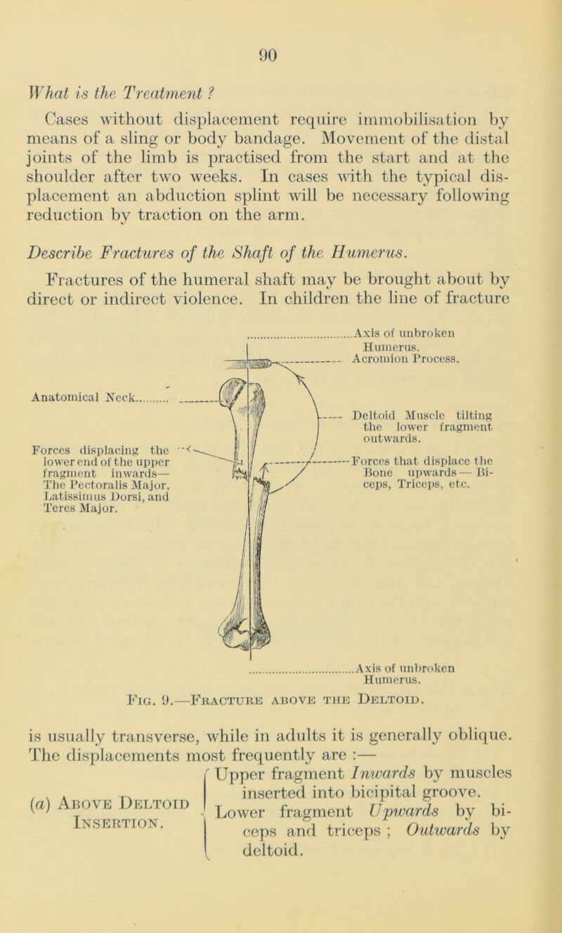 What is the Treatment ? Cases without displacement require immobilisation by means of a sling or body bandage. Movement of the distal joints of the limb is practised from the start and at the shoulder after two weeks. In cases with the typical dis- placement an abduction splint will be necessary following reduction by traction on the arm. Describe Fractures of the Shaft of the Humerus. Fractures of the humeral shaft may be brought about by direct or indirect violence. In children the line of fracture Axis of unbroken Fig. 9.—Fracture above the Deltoid. is usually transverse, while in adults it is generally oblique. The displacements most frequently are :— Upper fragment Inwards by muscles inserted into bicipital groove. Lower fragment Upwards by bi- ceps and triceps ; Outwards by deltoid. (a) Above Deltoid Insertion.