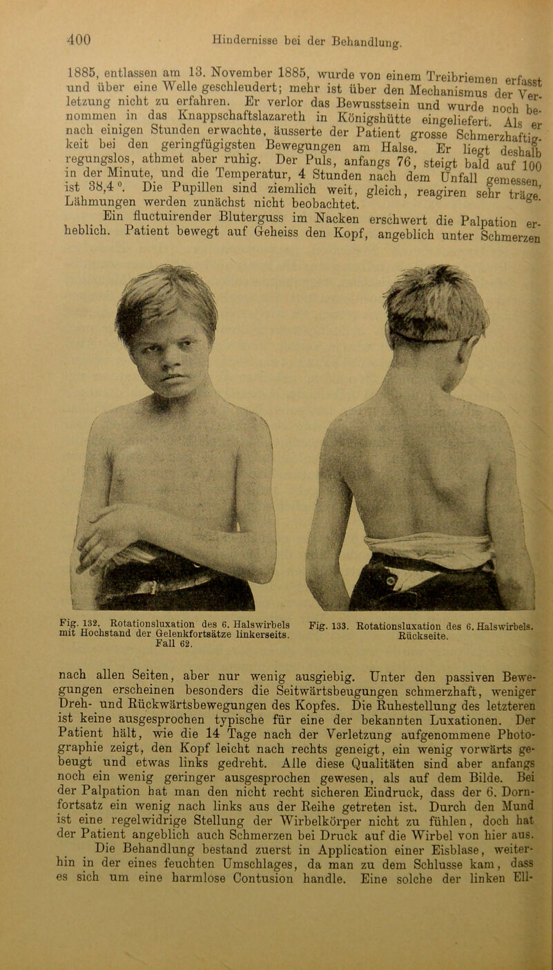 1885, entlassen am 13. November 1885, wurde von einem Treibriemen erfasst und über eine Welle geschleudert; mehr ist über den Mechanismus der Ver- letzung nicht zu erfahren. Er verlor das Bewusstsein und wurde noch he nommen in das Knappschaftslazareth in Königshütte eingeliefert Als nach einigen Stunden erwachte, äusserte der Patient grosse Schmerzhaftia keit bei den geringfügigsten Bewegungen am Halse. Er liegt deshalh regungslos, athmet aber ruhig. Der Puls, anfangs 76, steigt bald auf 100 in der Minute, und die Temperatur, 4 Stunden nach dem Unfall gemessen ist 38,4°. Die Pupillen sind ziemlich weit, gleich, reagiren sehr träge’ Lähmungen werden zunächst nicht beobachtet. 6 Ein fluctuirender Bluterguss im Nacken erschwert die Palpation er lieblich. Patient bewegt auf Geheiss den Kopf, angeblich unter Schmerzen Rotationsluxation des 6. Halswirbels Fig. 133. Rotationsluxation des 6. Halswirbels, mit Hochstand der Gelenkfortsätze linkerseits. Rückseite Fall 62. nach allen Seiten, aber nur wenig ausgiebig. Unter den passiven Bewe- gungen erscheinen besonders die Seitwärtsbeugungen schmerzhaft, weniger Dreh- und Rückwärtsbewegungen des Kopfes. Die Ruhestellung des letzteren ist keine ausgesprochen typische für eine der bekannten Luxationen. Der Patient hält, wie die 14 Tage nach der Verletzung aufgenommene Photo- graphie zeigt, den Kopf leicht nach rechts geneigt, ein wenig vorwärts ge- beugt und etwas links gedreht. Alle diese Qualitäten sind aber anfangs noch ein wenig geringer ausgesprochen gewesen, als auf dem Bilde. Bei der Palpation hat man den nicht recht sicheren Eindruck, dass der 6. Dorn- fortsatz ein wenig nach links aus der Reihe getreten ist. Durch den Mund ist eine regelwidrige Stellung der Wirbelkörper nicht zu fühlen, doch hat der Patient angeblich auch Schmerzen bei Druck auf die Wirbel von hier aus. Die Behandlung bestand zuerst in Application einer Eisblase, weiter- hin in der eines feuchten Umschlages, da man zu dem Schlüsse kam, dass es sich um eine harmlose Contusion handle. Eine solche der linken Eli-