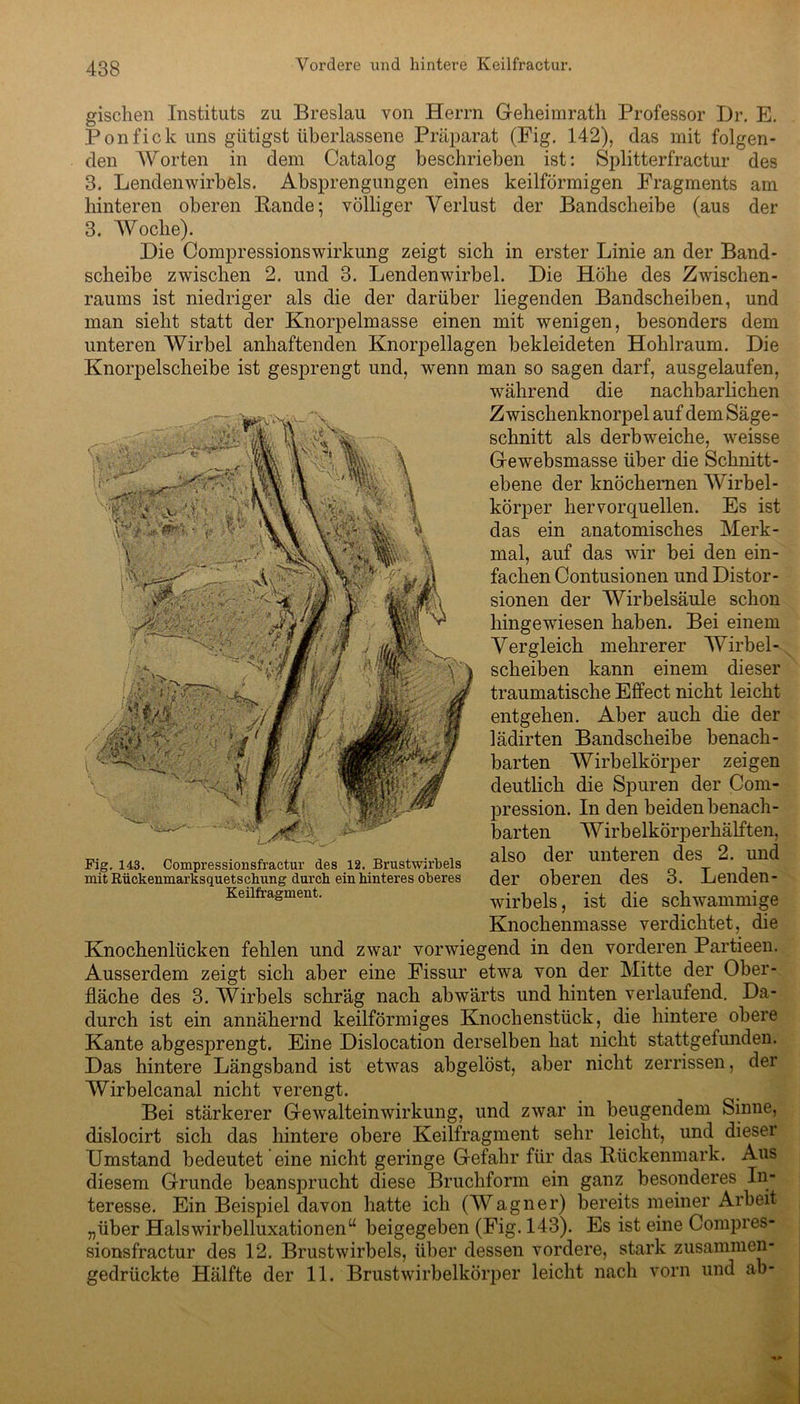 gischen Instituts zu Breslau von Herrn Geheimrath Professor Dr. E. Ponfick uns gütigst überlassene Präparat (Fig. 142), das mit folgen- den Worten in dem Catalog beschrieben ist: Splitterfractur des 3. Lendenwirbels. Absprengungen eines keilförmigen Fragments am hinteren oberen Bande; völliger Verlust der Bandscheibe (aus der 3. Woche). Hie Compressionswirkung zeigt sich in erster Linie an der Band- scheibe zwischen 2. und 3. Lendenwirbel. Die Höhe des Zwischen- raums ist niedriger als die der darüber liegenden Bandscheiben, und man sieht statt der Knorpelmasse einen mit wenigen, besonders dem unteren Wirbel anhaftenden Knorpellagen bekleideten Hohlraum. Die Knorpelscheibe ist gesprengt und, wenn man so sagen darf, ausgelaufen, Knochenmasse verdichtet, die Knochenlücken fehlen und zwar vorwiegend in den vorderen Partieen. Ausserdem zeigt sich aber eine Fissur etwa von der Mitte der Ober- fläche des 3. Wirbels schräg nach abwärts und hinten verlaufend. Da- durch ist ein annähernd keilförmiges Knochenstück, die hintere obere Kante abgesprengt. Eine Dislocation derselben hat nicht stattgefunden. Das hintere Längsband ist etwas abgelöst, aber nicht zerrissen, der Wirbelcanal nicht verengt. Bei stärkerer Gewalteinwirkung, und zwar in beugendem Sinne, dislocirt sich das hintere obere Keilfragment sehr leicht, und dieser Umstand bedeutet eine nicht geringe Gefahr für das Bückenmark. Aus diesem Grunde beansprucht diese Bruchform ein ganz besonderes In- teresse. Ein Beispiel davon hatte ich (Wagner) bereits meiner Arbeit „über Halswirbelluxationen“ beigegeben (Fig. 143). Es ist eine Compres- sionsfractur des 12. Brustwirbels, über dessen vordere, stark zusammen- gedrückte Hälfte der 11. Brustwirbelkörper leicht nach vorn und ab- Fig. 143. Compressionsfraetur des 12. Brustwirbels mit Rückenmarksquetschung durch ein hinteres oberes Keilfragment. während die nachbarlichen Zwischenknorpel auf dem Säge- schnitt als derbweiche, weisse Gewebsmasse über die Schnitt- ebene der knöchernen Wirbel- körper hervorquellen. Es ist das ein anatomisches Merk- mal, auf das wir bei den ein- fachen Contusionen und Distor- sionen der Wirbelsäule schon hingewiesen haben. Bei einem Vergleich mehrerer Wirbel- scheiben kann einem dieser traumatische Effect nicht leicht entgehen. Aber auch die der lädirten Bandscheibe benach- barten Wirbelkörper zeigen deutlich die Spuren der Com- pression. In den beiden benach- barten Wirbelkörperhälften, also der unteren des 2. und der oberen des 3. Lenden- wirbels, ist die schwammige