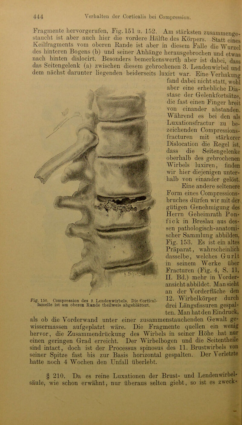 Fragmente hervorgerufen, Fig.151 u. 152. Am stärksten zusammenge- staucht ist aber auch hier die vordere Hälfte des Körpers. Statt eines Keilfragments vom oberen Rande ist aber in diesem Falle die Wurzel des hinteren Bogens (b) und seiner Anhänge herausgebrochen und etwas nach hinten dislocirt. Besonders bemerkenswert!! aber ist dabei, dass das Seitengelenk (a) zwischen diesem gebrochenen 3. Lendenwirbel und dem nächst darunter liegenden beiderseits luxirt war. Eine Verhakung fand dabei nicht statt, wohl aber eine erhebliche Dia- stase der Gelenkfortsätze, die fast einen Finger breit von einander abstanden. Während es bei den als Luxationsfractur zu be- zeichenden Compressions- fracturen mit stärkerer Dislocation die Regel ist, dass die Seitengelenke oberhalb des gebrochenen Wirbels luxiren, finden wir hier diejenigen unter- halb von einander gelöst. Eine andere seltenere Form eines Compressions- bruches dürfen wir mit der gütigen Genehmigung des Herrn Geheimrath Pon- fick in Breslau aus des- sen pathologisch-anatomi- scher Sammlung abbilden, Fig. 153. Es ist ein altes Präparat, wahrscheinlich dasselbe, welches Gurlt in seinem Werke über Fracturen (Fig. 4, S. 11, 11. Bd.) mehr in Vorder- ansicht abbildet. Man sieht an der Vorderfläche den 12. Wirbelkörper durch drei Längsfissuren gespal- ten. Man hat den Eindruck, als ob die Vorder wand unter einer zusammenstauchenden Gewalt ge- wissermassen aufgeplatzt wäre. Die Fragmente quellen ein wrenig hervor, die Zusammendrückung des Wirbels in seiner Höhe hat nur einen geringen Grad erreicht. Der Wirbelbogen und die Seitentheile sind intact, doch ist der Processus spinosus des 11. Brustwirbels von seiner Spitze fast bis zur Basis horizontal gespalten. Der V erletzte hatte noch 4 Wochen den Unfall überlebt. Fig. 150. Compression des 2. Lendenwirbels. Die Cortical- lamelle ist am oberen Rande theilweis abgeblättert. § 210. Da es reine Luxationen der Brust- und Lendenwirbel- säule, wie schon erwähnt, nur überaus selten giebt, so ist es zweck- •»a