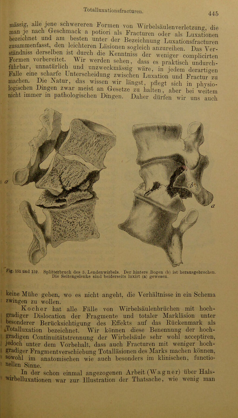 Totalluxaticmsfracturen. 445 massig, alle jene schwereren Formen von Wirbelsäulenverletzung, die man je nach Geschmack a potiori als Fracturen oder als Luxationen bezeichnet und am besten unter der Bezeichnung Luxationsfracturen zusammenfasst, den leichteren Läsionen sogleich anzureihen. Das Ver- ständniss derselben ist durch die Kenntniss der weniger complicirten Formen vorbereitet Wir werden sehen, dass es praktisch undurch- fuhrbar, unnatürlich und unzweckmässig wäre, in jedem derartigen Falle eine scharfe Unterscheidung zwischen Luxation und Fractur zu machen. Die Natur, das wissen wir längst, pflegt sich in physio- logischen Dingen zwar meist an Gesetze zu halten, aber bei weitem nicht immer m pathologischen Dingen. Daher dürfen wir uns auch Fig. 151 und 152. Splitterbruch des 3. Lendenwirbels. Der hintere Bogen (b) ist herausgebrochen. Die Seitengelenke sind beiderseits luxirt (a) gewesen. keine Mühe geben, wo es nicht angeht, die Verhältnisse in ein Schema zwingen zu wollen. Kocher hat alle Fälle von Wirbelsäulenbrüchen mit hoch- gradiger Dislocation der Fragmente und totaler Markläsion unter besonderer Berücksichtigung des Effekts auf das Bückenmark als «Totalluxation bezeichnet. Wir können diese Benennung der hoch- gradigen Continuitätstrennung der Wirbelsäule sehr wohl acceptiren, jedoch unter dem Vorbehalt, dass auch Fracturen mit weniger hoch- gradiger Fragmentverschiebung Totalläsionen des Marks machen können, sowohl im anatomischen wie auch besonders im klinischen, functio- aellen Sinne. In der schon einmal angezogenen Arbeit (Wagner) über Hals- wirbelluxationen war zur Illustration der Thatsache, wie wenig man