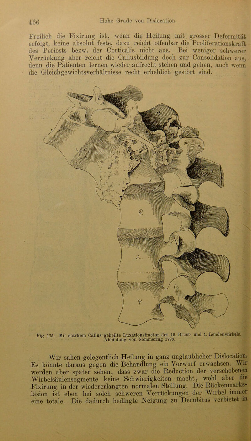 Freilich die Fixirung ist, wenn die Heilung mit grosser Deformität erfolgt, keine absolut feste, dazu reicht offenbar die Proliferationskraft des Periosts bezw. der Corticalis nicht aus. Bei weniger schwerer Verrückung aber reicht die Callusbildung doch zur Consolidation aus, denn die Patienten lernen wieder aufrecht stehen und gehen, auch wenn die (Heicligewichtsverhältnisse recht erheblich gestört sind. Wir sahen gelegentlich Heilung in ganz unglaublicher Dislocation. Es könnte daraus gegen die Behandlung ein Vorwurf erwachsen. Wir werden aber später sehen, dass zwar die Reduction der verschobenen Wirbelsäulensegmente keine Schwierigkeiten macht, wohl aber die Fixirung in der wiedererlangten normalen Stellung. Die Rückenmarks- läsion ist eben bei solch schweren Verrückungen der AVirbel immer eine totale. Die dadurch bedingte Neigung zu Decubitus verbietet in