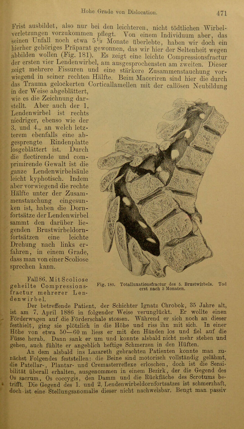 Frist ausbildet, also nur bei den leichteren, nicht tödtlichen Wirbel - Verletzungen voizukommen pflegt. Von einem Individuum aber, das seinen Unfall noch etwa 5 */2 Monate überlebte, haben wir doch ein hierbei gehöiiges Piäpaiat gewonnen, das wir hier der Seltenheit wegen abbilden wollen (Big. 181). Es zeigt eine leichte Compressionsfractur der eisten viel Lendenwirbel, am ausgesprochensten am zweiten. Dieser zeigt mehl eie. Fissuien und eine stärkere Zusammenstauchung vor- wiegend in seinei rechten Hälfte. Beim Maceriren sind hier die durch das Tiauma gelockeiten Corticallamellen mit der callösen Neubildung in der Weise abgeblättert, wie es die Zeichnung dar- stellt. Aber auch der 1. Lendenwirbel ist rechts I niedriger, ebenso wie der 3. und 4., an welch letz- terem ebenfalls eine ab- gesprengte Bindenplatte losgeblättert ist. Durch die flectirende und com- primirende Gewalt ist die ganze Lendenwirbelsäule leicht kyphotisch. Indem aber vorwiegend die rechte Hälfte unter der Zusam- menstauchung eingesun- ken ist, haben die Dorn- fortsätze der Lendenwirbel sammt den darüber lie- genden Brustwirbeldorn- fortsätzen eine leichte Drehung nach links er- fahren, in einem Grade, dass man von einer Scoliose sprechen kann. Fall86. MitScoliose geheilte Compressions- fractur mehrerer Len- denwirbel. Der betreffende Patient, der Schichter Ignatz Chrobok, 35 Jahre alt, ist am 7. April 1886 in folgender Weise verunglückt. Er wollte einen Förderwagen auf die Förderschale stossen. Während er sich noch an dieser festhielt, ging sie plötzlich in die Höhe und riss ihn mit sich. In einer Höhe von etwa 50—60 m liess er mit den Händen los und fiel auf die Füsse herab. Dann sank er um und konnte alsbald nicht mehr stehen und gehen, auch fühlte er angeblich heftige Schmerzen in den Hüften. An dem alsbald ins Lazareth gebrachten Patienten konnte man zu- nächst Folgendes feststellen: die Beine sind motorisch vollständig gelähmt, die Patellar-, Plantar- und Cremasterreflexe erloschen, doch ist die Sensi- bilität überall erhalten, ausgenommen in einem Bezirk, der die Gegend des Os sacrum, Os coccygis, den Damm und die Rückfläche des Scrotums be- r trifft. Die Gegend des 1. und 2. Lendenwirbeldornfortsatzes ist schmerzhaft, doch ist eine Stellungsanomalie dieser nicht nachweisbar. Beugt man passiv Fig. 180. Totalluxationsfractur des 5. Brustwirbels. Tod erst nach 3 Monaten.