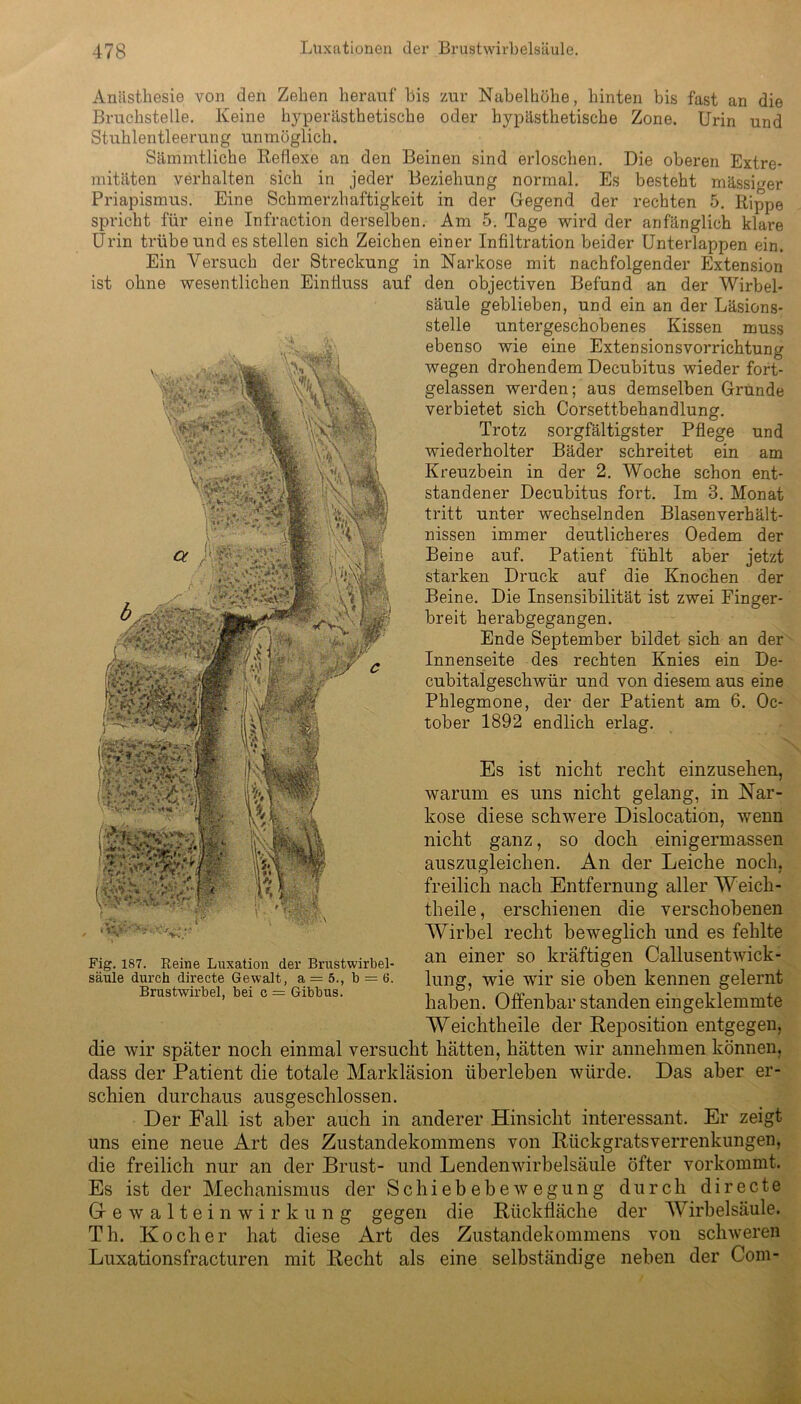 Anästhesie von den Zehen herauf bis zur Nabelhöhe, hinten bis fast an die Bruchstelle. Keine hyperästhetische oder hypästhetische Zone. Urin und Stuhlentleerung unmöglich. Sämmtliche Reflexe an den Beinen sind erloschen. Die oberen Extre- mitäten verhalten sich in jeder Beziehung normal. Es besteht mässmer Priapismus. Eine Schmerzhaftigkeit in der Gegend der rechten 5. Rippe spricht für eine Infraction derselben. Am 5. Tage wird der anfänglich klare Urin trübe und es stellen sich Zeichen einer Infiltration beider Unterlappen ein. Ein Versuch der Streckung in Narkose mit nachfolgender Extension ist ohne wesentlichen Einfluss auf den objectiven Befund an der Wirbel- säule geblieben, und ein an der Läsions- stelle untergeschobenes Kissen muss ebenso wie eine Extensionsvorrichtung wegen drohendem Decubitus wieder fort- gelassen werden; aus demselben Grunde verbietet sich Corsettbehandlung. Trotz sorgfältigster Pflege und wiederholter Bäder schreitet ein am Kreuzbein in der 2. Woche schon ent- standener Decubitus fort. Im 3. Monat tritt unter wechselnden Blasen Verhält- nissen immer deutlicheres Oedem der Beine auf. Patient fühlt aber jetzt starken Druck auf die Knochen der Beine. Die Insensibilität ist zwei Finger- breit herabgegangen. Ende September bildet sich an der Innenseite des rechten Knies ein De- cubitalgeschwür und von diesem aus eine Phlegmone, der der Patient am 6. Oc- tober 1892 endlich erlag. Es ist nicht recht einzusehen, warum es uns nicht gelang, in Nar- kose diese schwere Dislocation, wenn nicht ganz, so doch einigermassen auszugleichen. An der Leiche noch, freilich nach Entfernung aller Weich - theile, erschienen die verschobenen Wirbel recht beweglich und es fehlte an einer so kräftigen Callusentwick- lung, wie wir sie oben kennen gelernt haben. Offenbar standen eingeklemmte Weichtheile der Reposition entgegen, die wir später noch einmal versucht hätten, hätten wir annehmen können, dass der Patient die totale Markläsion überleben würde. Das aber er- schien durchaus ausgeschlossen. Der Eall ist aber auch in anderer Hinsicht interessant. Er zeigt uns eine neue Art des Zustandekommens von Rückgratsverrenkungen, die freilich nur an der Brust- und Lendenwirbelsäule öfter vorkommt. Es ist der Mechanismus der Schiebebewegung durch di recte Gewalteinwirkung gegen die Rückfläche der Wirbelsäule. Th. Kocher hat diese Art des Zustandekommens von schweren Luxationsfracturen mit Recht als eine selbständige neben der Com- \v*.‘V*..<*•••• ' IjtiL.Um*'. - .Vs ■‘■••V. **»?»•■• r | t'.'V * - * /Ar'!  Fig. 187. Reine Luxation der Brustwirbel- säule durch directe Gewalt, a = 5., b = 6. Brustwirbel, bei c = Gibbus.